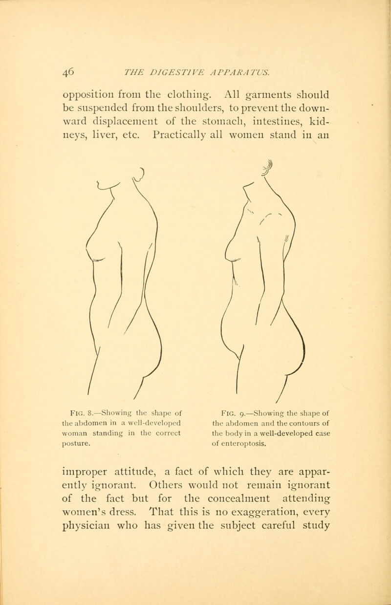 opposition from the clothing. All garments should be suspended from the shoulders, to prevent the down- ward displacement of the stomach, intestines, kid- neys, liver, etc. Practically all women stand in an FlG. 8.—Showing the shape of the abdomen in a well-developed woman standing in the correct posture. FlG. 9.—Showing the shape of the abdomen and the contours of the body in a well-developed case of enteroptosis. improper attitude, a fact of which they are appar- ently ignorant. Others would not remain ignorant of the fact but for the concealment attending women's dress. That this is no exaggeration, every physician who has given the subject careful study