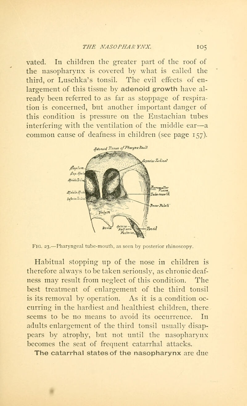 vated. In children the greater part of the roof of the nasopharynx is covered by what is called the third, or Luschka's tonsil. The evil effects of en- largement of this tissue by adenoid growth have al- ready been referred to as far as stoppage of respira- tion is concerned, but another important danger of this condition is pressure on the Eustachian tubes interfering with the ventilation of the middle ear—a common cause of deafness in children (see page 157). JjJemld T.stue of Pharynx fault Turlinal Tonsil FIG. 23.—Pharyngeal tube-mouth, as seen by posterior rhinoscopy. Habitual stopping up of the nose in children is therefore always to be taken seriously, as chronic deaf- ness may result from neglect of this condition. The best treatment of enlargement of the third tonsil is its removal by operation. As it is a condition oc- curring in the hardiest and healthiest children, there seems to be no means to avoid its occurrence. In adults enlargement of the third tonsil usually disap- pears by atrophy, but not until the nasopharynx becomes the seat of frequent catarrhal attacks. The catarrhal states of the nasopharynx are due