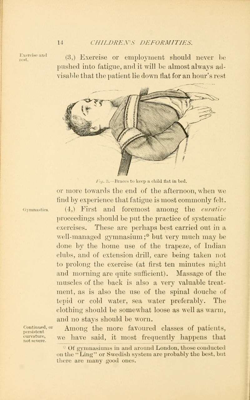 Exercise and rest. (3,) Exercise or employment should never be pushed into fatigue, and it will be almost always ad- visable that the patient lie down flat for an hour's rest (lontinued, or persistenl curvature, not severe. 1'ij. :',. -Braces to keep a child flat in bed. or more towards the end of the afternoon, when we find by experience that fatigue is most commonly felt. (4,) First and foremost among the curative proceedings should be put the practice of systematic- exercises. These are perhaps best carried out in a well-managed gymnasium ;* but very much may be done by the home use of the trapeze, of Indian clubs, and of extension drill, care being taken not to prolong the exercise (at first ten minutes night and morning are quite sufficient). Massage of the muscles of the back is also a very valuable treat- ment, as is also the use of the spinal douche of tepid or cold water, sea water preferably. The clothing should be somewhat loose as well as warm, and no stays should be worn. Among the more favoured classes of patients, we have said, it most frequently happens that ()! gymnasiums in and around Loudon, those conducted on the Ling or Swedish system are probably the best, but there are many good ours.