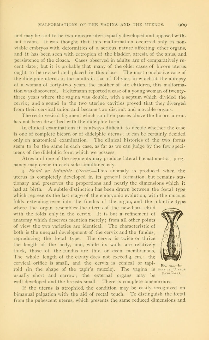 and maybe said to be two unicorn uteri equally developed and apposed with- out fusion. It was thought that this malformation occurred only in non- viable embryos with deformities of a serious nature affecting other organs, and it has been seen with ectropion of the bladder, atresia of the anus, and persistence of the cloaca. Cases observed in adults are of comparatively re- cent date; but it is probable that many of the older cases of bicorn uterus ought to be revised and placed in this class. The most conclusive case of the didelphic uterus in the adults is that of Olivier, in which at the autopsy of a woman of forty-two years, the mother of six children, this malforma- tion was discovered. Heitzmann reported a case of a young woman of twenty- three years where the vagina was double, with a septum which divided the cervix ; and a sound in the two uterine cavities proved that they diverged from their cervical union and became two distinct and movable organs. The recto-vesical ligament which so often passes above the bicorn uterus has not been described with the didelphic form. In clinical examinations it is always difficult to decide whether the case is one of complete bicorn or of didelphic uterus; it can be certainly decided only on anatomical examination. The clinical histories of the two forms seem to be the same in each case, as far as we can judge by the few speci- mens of the didelphic form which we possess. Atresia of one of the segments may produce lateral hxmatometra; preg- nancy may occur in each side simultaneously. 4. Foetal or Infantile ['Ants.—This anomaly is produced when the uterus is completely developed in its general formation, but remains sta- tionary and preserves the proportions and nearly the dimensions which it had at birth. A subtle distinction has been drawn between the fatal type which represents the last stage of the embryonic evolution, with the mucous folds extending even into the fundus of the organ, and the infantile type where the organ resembles- the uterus of the new-born child with the folds only in the cervix. It is but a refinement of anatomy which deserves mention merely; from all other points of view the two varieties are identical. The characteristic of both is the unequal development of the cervix and the fundus, reproducing the fcetal type. The cervix is twice or thrice the length of the body, and, while its walls are relatively thick, those of the fundus are thin or even membranous. The whole length of the cavity does not exceed 4 cm. ; the cervical orifice is small, and the cervix is conical or tapi- 1 Fig. 594.—In- roid (in the shape of the tapir's muzzle). The vagina is panto* Uterus usually short and narrow; the external organs may be well developed and the breasts small. There is complete amenorrhcea. If the uterus is atrophied, the condition may be easily recognized on bimanual palpation with the aid of rectal touch. To distinguish the foetal from the pubescent uterus, which presents the same reduced dimensions and