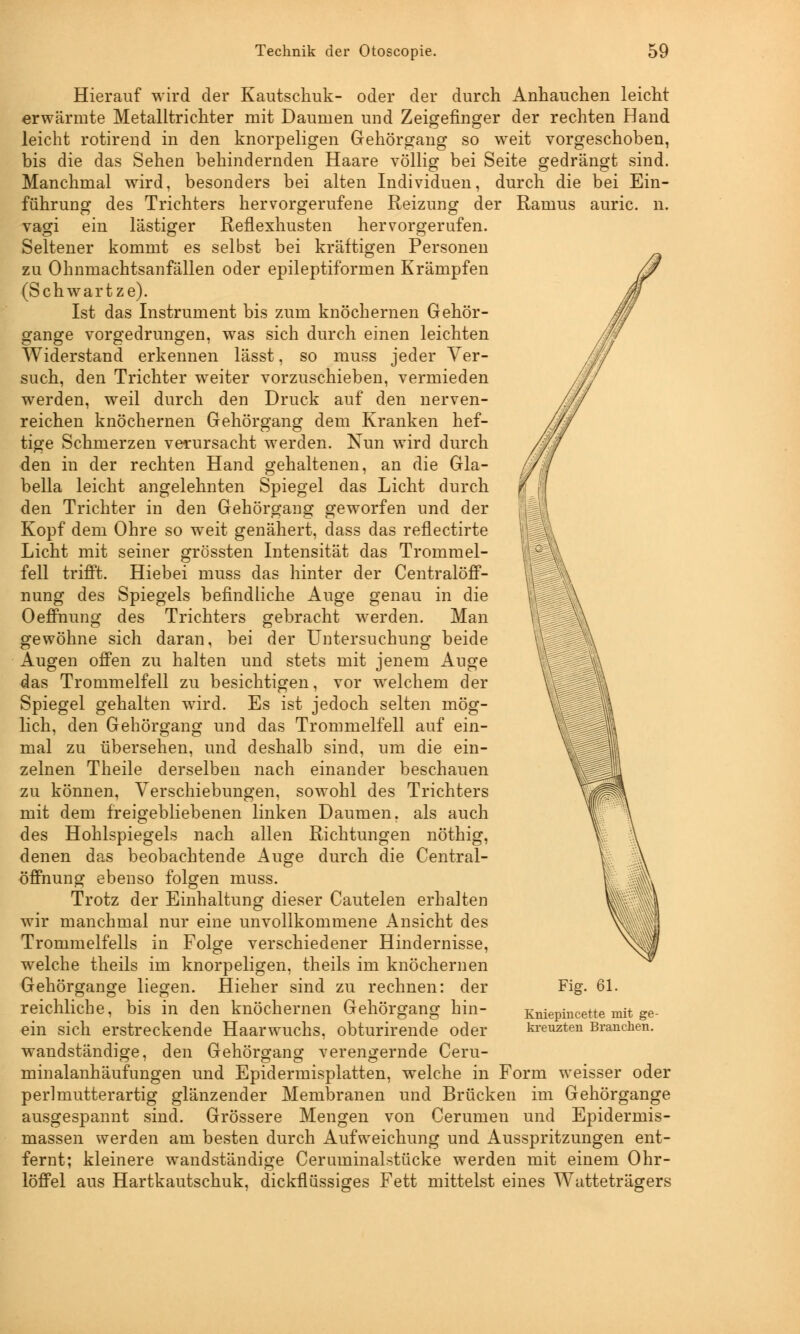 Hierauf wird der Kautschuk- oder der durch Anhauchen leicht erwärmte Metalltrichter mit Daumen und Zeigefinger der rechten Hand leicht rotirend in den knorpeligen Gehörgang so weit vorgeschoben, bis die das Sehen behindernden Haare völlig bei Seite gedrängt sind. Manchmal wird, besonders bei alten Individuen, durch die bei Ein- führung des Trichters hervorgerufene Reizung der Raums auric. n. vagi ein lästiger Reflexhusten hervorgerufen. Seltener kommt es selbst bei kräftigen Personen zu Ohnmachtsanfällen oder epileptiformen Krämpfen (Schwartze). Ist das Instrument bis zum knöchernen Gehör- gange vorgedrungen, was sich durch einen leichten Widerstand erkennen lässt, so muss jeder Ver- such, den Trichter weiter vorzuschieben, vermieden werden, weil durch den Druck auf den nerven- reichen knöchernen Gehörgang dem Kranken hef- tige Schmerzen verursacht werden. Nun wird durch den in der rechten Hand gehaltenen, an die Gla- bella leicht angelehnten Spiegel das Licht durch den Trichter in den Gehörgang geworfen und der Kopf dem Ohre so weit genähert, dass das reflectirte Licht mit seiner grössten Intensität das Trommel- fell trifft. Hiebei muss das hinter der Centralöff- nung des Spiegels befindliche Auge genau in die Oeffnung des Trichters gebracht werden. Man gewöhne sich daran, bei der Untersuchung beide Augen offen zu halten und stets mit jenem Auge das Trommelfell zu besichtigen, vor welchem der Spiegel gehalten wird. Es ist jedoch selten mög- lich, den Gehörgang und das Trommelfell auf ein- mal zu übersehen, und deshalb sind, um die ein- zelnen Theile derselben nach einander beschauen zu können, Verschiebungen, sowohl des Trichters mit dem freigebliebenen linken Daumen, als auch des Hohlspiegels nach allen Richtungen nöthig, denen das beobachtende Auge durch die Central- öffnung ebenso folgen muss. Trotz der Einhaltung dieser Cautelen erhalten wir manchmal nur eine unvollkommene Ansicht des Trommelfells in Folge verschiedener Hindernisse, welche theils im knorpeligen, theils im knöchernen Gehörgange liegen. Hieher sind zu rechnen: der reichliche, bis in den knöchernen Gehörgang hin- ein sich erstreckende Haarwuchs, obturirende oder wandständige, den Gehörgang verengernde Ceru- minalanhäufungen und Epidermisplatten, welche in Form weisser oder perlmutterartig glänzender Membranen und Brücken im Gehörgange ausgespannt sind. Grössere Mengen von Cerumen und Epidermis- massen werden am besten durch Aufweichung und Ausspritzungen ent- fernt; kleinere wandständige Ceruminalstücke werden mit einem Ohr- löffel aus Hartkautschuk, dickflüssiges Fett mittelst eines Watteträgers Fig. 61. Kniepiucette mit ge- kreuzten Branchen.