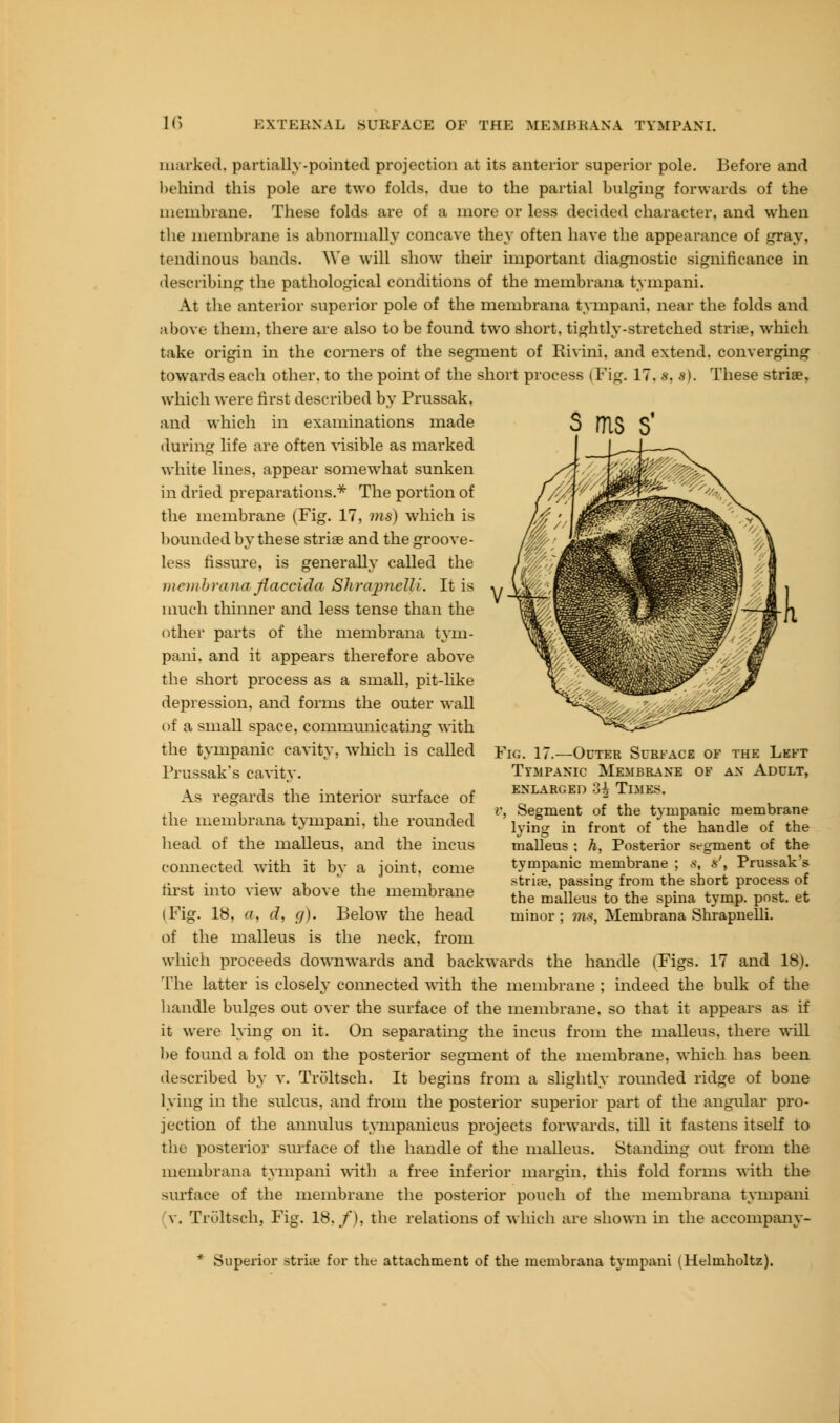 1<) EXTERNAL SURFACE OF THE MEMBRANA TYMPANI s ms s* marked, partially-pointed projection at its anterior superior pole. Before and behind this pole are two folds, due to the partial bulging forwards of the membrane. These folds are of a more or less decided character, and when the membrane is abnormally concave they often have the appearance of gray, tendinous bands. We will show their important diagnostic significance in describing the pathological conditions of the membrana tympani. At the anterior superior pole of the membrana tympani. near the folds and above them, there are also to be found two short, tightly-stretched strife, which take origin in the corners of the segment of Rivini, and extend, converging towards each other, to the point of the short process (Fig. 17. s, s). These striae, which were first described by Prussak. and which in examinations made •luring life are often visible as marked white lines, appear somewhat sunken in dried preparations.* The portion of the membrane (Fig. 17, vis) which is hounded by these striae and the groove- less fissure, is generally called the membranafiaedda Shrajmelli. It is much thinner and less tense than the other parts of the membrana tym- pani. and it appears therefore above the short process as a small, pit-like depression, and forms the outer wall of a small space, communicating with the tympanic cavity, which is called Prussak's cavity. As regards the interior surface of the membrana tympani, the rounded head of the malleus, and the incus connected with it by a joint, come first into view above the membrane (Fig. 18, a, d, g). Below the head Fig. 17.—Outer Surface of the Left Tympanic Membrane of an Adult, ENLARGED oh TlMES. v, Segment of the tympanic membrane lying in front of the handle of the malleus ; A, Posterior segment of the tympanic membrane ; s, s', Prussak's stria?, passing from the short process of the malleus to the spina tymp. post, et minor ; tns, Membrana Shrapnelli. of the malleus is the neck, from which proceeds downwards and backwards the handle (Figs. 17 and 18). The latter is closely connected with the membrane ; indeed the bulk of the handle bulges out over the surface of the membrane, so that it appears as if it were lying on it. On separating the incus from the malleus, there will be found a fold on the posterior segment of the membrane, which has been described by v. Troltsch. It begins from a slightly rounded ridge of bone lying in the sulcus, and from the posterior superior part of the angular pro- jection of the annulus tympanicus projects forwards, till it fastens itself to the posterior surface of the handle of the malleus. Standing out from the membrana tympani with a free inferior margin, this fold forms with the surface of the membrane the posterior pouch of the membrana tympani (v. Troltsch, Fig. 18./), the relations of which are shown in the accompany- * Superior striie for the attachment of the membrana tympani (Helmholtz).