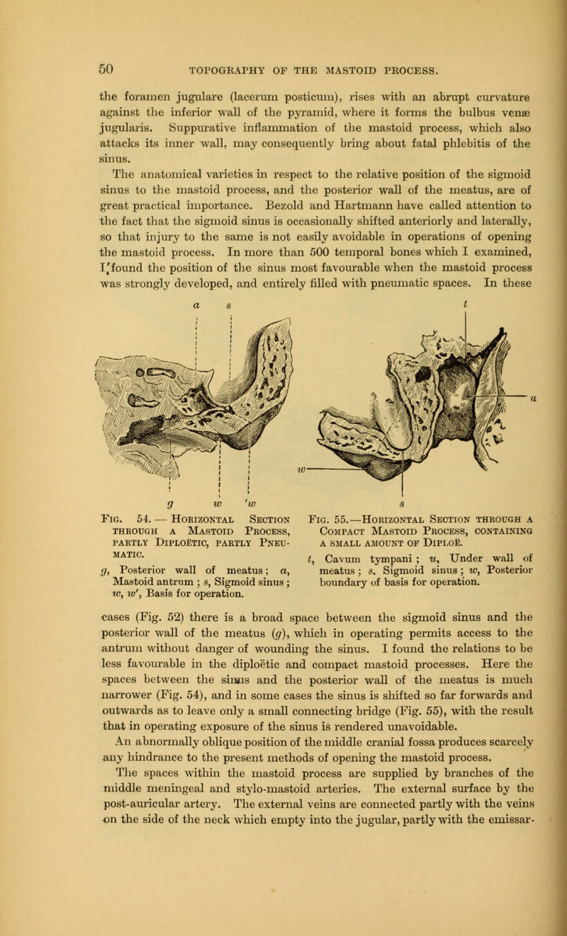 the foramen jugulare (lacerum posticum), rises with an abrupt curvature against the inferior wall of the pyramid, where it forms the bulbus venae jugularis. Suppurative inflammation of the mastoid process, which also attacks its inner wall, may consequently bring about fatal phlebitis of the The anatomical varieties in respect to the relative position of the sigmoid sinus to the mastoid process, and the posterior wall of the meatus, are of great practical importance. Bezold and Hartmann have called attention to the fact that the sigmoid sinus is occasionally shifted anteriorly and laterally, so that injury to the same is not easily avoidable in operations of opening the mastoid process. In more than 500 temporal bones which I examined, 11 found the position of the sinus most favourable when the mastoid process was strongly developed, and entirely filled with pneumatic spaces. In these Fig. 54. — Horizontal Section through a mastoid process, partly dlploetic, partly pneu- MATIC. {/, Posterior wall of meatus; a, Mastoid antrum ; s, Sigmoid sinus ; w, w', Basis for operation. Fig. 55.—Horizontal Section through a Compact Mastoid Process, containing a small amount of Diploe. t, Cavum tympani ; w. Under wall of meatus ; s. Sigmoid sinus ; w, Posterior boundary of basis for operation. eases (Fig. 52) there is a broad space between the sigmoid sinus and the posterior wall of the meatus (g), which in operating permits access to the antrum without danger of wounding the sinus. I found the relations to be less favourable in the diploetic and compact mastoid processes. Here the spaces between the sinus and the posterior wall of the meatus is much narrower (Fig. 54), and in some cases the sinus is shifted so far forwards and outwards as to leave only a small connecting bridge (Fig. 55), with the result that in operating exposure of the sinus is rendered unavoidable. An abnormally oblique position of the middle cranial fossa produces scarcely any hindrance to the present methods of opening the mastoid process. The spaces within the mastoid process are supplied by branches of the middle meningeal and stylo-mastoid arteries. The external surface by the post-auricular artery. The external veins are connected partly with the veins on the side of the neck which empty into the jugular, partly with the emissar-