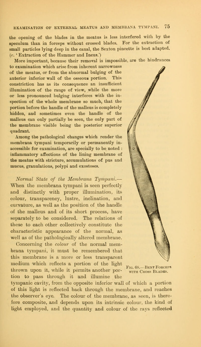 the opening of the blades in the meatus is less interfered with by the speculum than in forceps without crossed blades. For the extraction of small particles lying deep in the canal, the Sexton pincette is best adapted. [v. ' Extraction of the Hammer and Incus.') More important, because their removal is impossible, are the hindrances to examination which arise from inherent narrowness of the meatus, or from the abnormal bulging of the anterior inferior wall of the osseous portion. This constriction has as its consequence an insufficient illumination of the range of view, while the more or less pronounced bulging interferes with the in- spection of the whole membrane so much, that the portion before the handle of the malleus is completely hidden, and sometimes even the handle of the malleus can only partially be seen, the only part of the membrane visible being the posterior superior quadrant. Among the pathological changes which render the membrana tympani temporarily or permanently in- accessible for examination, are specially to be noted : inflammatory affections of the lining membrane of the meatus with stricture, accumulations of pus and mucus, granulations, polypi and exostoses. Normal State of the Membrana Tympani.— When the membrana tympani is seen perfectly and distinctly with proper illumination, its colour, transparency, lustre, inclination, and curvature, as well as the position of the handle of the malleus and of its short process, have separately to be considered. The relations of these to each other collectively constitute the characteristic appearance of the normal, as well as of the pathologically altered membrane. Concerning the colour of the normal mem- brana tympani, it must be remembered that this membrane is a more or less transparent medium which reflects a portion of the light ,, ., , ., . ., L, Fig. 6b.-Bknt Forceps thrown upon it, while it permits another por- WITH cross Blades. tion to pass through it and illumine the tympanic cavity, from the opposite inferior wall of which a portion of this light is reflected back through the membrane, and reaches the observer's eye. The colour of the membrane, as seen, is there- fore composite, and depends upon its intrinsic colour, the kind of light employed, and the quantity and colour of the rays reflected