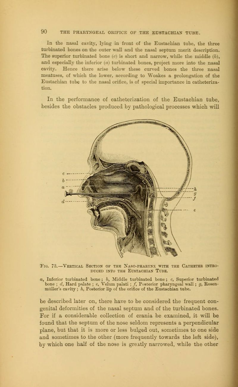 In the nasal cavity, lying in front of the Eustachian tube, the three turbinated bones on the outer wall and the nasal septum merit description. The superior turbinated bone ic> is short and narrow, while the niiddl and especially the inferior (a) turbinated bones, project more into the nasal cavity. Hence there arise below these curved bones the three nasal meatuses, of which the lower, according to \Yoakes a prolongation of the Eustachian tube to the nasal orifice, is of special importance in catheteriza- tion. L: the performance of -on of the Eustachian tube, besides the obstacles produced by pathological processes which will Vl .73. -Vertical Section of the Xaso-pharynx with the Catheter intro- duced into the Eustachian- Tube. a, Inferior turbinated bone; h, Middle turbinated bone; c, Superior turbinated bone : '/, Hard palate : <e, Velum palati ; /, Posterior pharyngeal wall ; g, Rosen- miiller'i cavity ; :. I' -:crior lip of the orifice of the Eustachian tube. be described later on, there have to be considered the frequent con- genital deformities of the nasal septum and of the turbinated bones. For if a considerable collection of crania be examined, it will be found that the septum of the nose seldom represents a perpendicular plane, but that it is more or less bulged out, sometimes to one side and sometimes to the other (more frequently towards the left side), by which one half of the nose is greatly narrowed, while the other