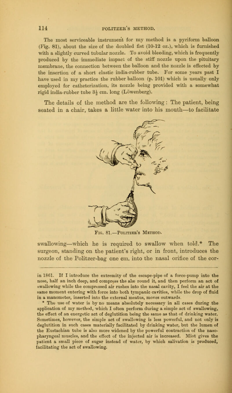 The most serviceable instrument for my method is a pyriform balloon (Fig. 81), about the size of the doubled fist (10-12 oz.), which is furnished with a slightly curved tubular nozzle. To avoid bleeding, which is frequently produced by the immediate impact of the stiff nozzle upon the pituitary membrane, the connection between the balloon and the nozzle is effected by the insertion of a short elastic india-rubber tube. For some years past I have used in my practice the rubber balloon (p. 101) which is usually only employed for catheterization, its nozzle being provided with a somewhat rigid india-rubber tube 3| cm. long (Luwenberg). The details of the method are the following : The patient, being seated in a chair, takes a little water into his mouth—to facilitate Fig. 81.—Politzer's Method. swallowing—which he is required to swallow when told.* The surgeon, standing on the patient's right, or in front, introduces the nozzle of the Politzer-bag one cm. into the nasal orifice of the cor- in 1861. If I introduce the extremity of the escape-pipe of a force-pump into the nose, half an inch deep, and compress the alee round it, and then perform an act of swallowing while the compressed air rushes into the nasal cavity, I feel the air at the same moment entering with force into both tympanic cavities, while the drop of fluid in a manometer, inserted into the external meatus, moves outwards. * The use of water is by no means absolutely necessary in all cases during the application of my method, which I often perform during a simple act of swallowing, the effect of an energetic act of deglutition being the same as that of drinking water. Sometimes, however, the simple act of swallowing is less powerful, and not only is deglutition in such cases materially facilitated by drinking water, but the lumen of the Eustachian tube is also more widened by the powerful contraction of the naso- pharyngeal muscles, and the effect of the injected air is increased. Miot gives the patient a small piece of sugar instead of water, by which salivation is produced, facilitating the act of swallowing.