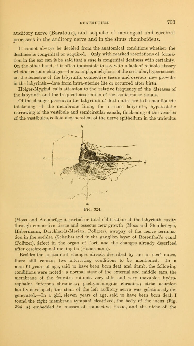 auditory nerve (Baratoux), and sequels of meningeal and cerebral processes in the auditory nerve and in the sinus rhomboideus. It cannot always be decided from the anatomical conditions whether the deafness is congenital or acquired. Only with marked restrictions of forma- tion in the ear can it be said that a case is congenital deafness with certainty. On the other hand, it is often impossible to say with a lack of reliable history whether certain changes—for example, anchylosis of the ossicular, hyperostoses on the fenestrae of the labyrinth, connective tissue and osseous new growths in the labyrinth—date from intra-uterine life or occurred after birth. Holger-Mygind calls attention to the relative frequency of the diseases of the labyrinth and the frequent association of the semicircular canals. Of the changes present in the labyrinth of deaf-mutes are to be mentioned : thickening of the membrane lining the osseous labyrinth, hyperostotic narrowing of the vestibule and semicircular canals, thickening of the vesicles of the vestibules, colloid degeneration of the nerve epithelium in the utriculus (Moos and Steinbriigge), partial or total obliteration of the labyrinth cavity through connective tissue and osseous new growth (Moos and Steinbriigge, Habermann, Burckhardt-Merian, Politzer), atrophy of the nerve termina- tion in the cochlea (Scheibe) and in the ganglion layer of Kosenthal's canal (Politzer), defect in the organ of Corti and the changes already described after cerebro-spinal meningitis (Habermann). Besides the anatomical changes already described by me in deaf-mutes, there still remain two interesting conditions to be mentioned. In a man 61 years of age, said to have been born deaf and dumb, the following conditions were noted : a normal state of the external and middle ears, the membrane of the fenestra rotunda very thin and very movable; hydro- cephalus internus chronicus; pachymeningitis chronica; striae acusticae faintly developed; the stem of the left auditory nerve was gelatinously de- generated.—In a girl, eleven years of age, said to have been born deaf, I found the right membrana tympani cicatrized, the body of the incus (Fig. 324, a) embedded in masses of connective tissue, and the niche of the