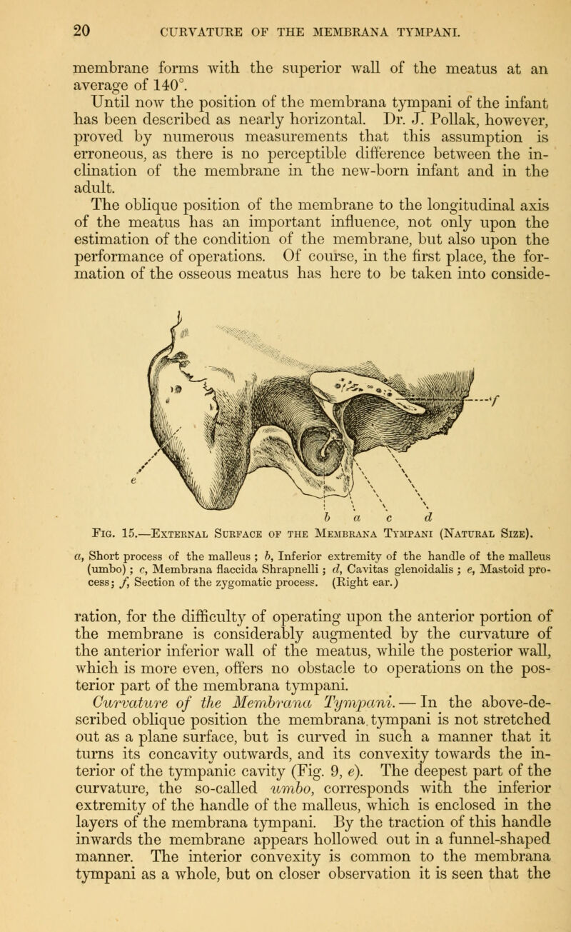 membrane forms with the superior wall of the meatus at an average of 140°. Until now the position of the membrana tympani of the infant has been described as nearly horizontal. Dr. J. Pollak, however, proved by numerous measurements that this assumption is erroneous, as there is no perceptible difference between the in- clination of the membrane in the new-born infant and in the adult. The oblique position of the membrane to the longitudinal axis of the meatus has an important influence, not only upon the estimation of the condition of the membrane, but also upon the performance of operations. Of course, in the first place, the for- mation of the osseous meatus has here to be taken into conside- b a c d Fig. 15.—Exteknal Surface of the Membrana Tympani (Natural Size). a, Short process of the malleus ; b, Inferior extremity of the handle of the malleus (umbo); c, Membrana flaccida Shrapnelli; d, Cavitas glenoidalis ; e, Mastoid pro- cess; f, Section of the zygomatic process. (Eight ear.) ration, for the difficulty of operating upon the anterior portion of the membrane is considerably augmented by the curvature of the anterior inferior wall of the meatus, while the posterior wall, which is more even, offers no obstacle to operations on the pos- terior part of the membrana tympani. Curvature of the Membrana Tympani. — In the above-de- scribed oblique position the membrana. tympani is not stretched out as a plane surface, but is curved in such a manner that it turns its concavity outwards, and its convexity towards the in- terior of the tympanic cavity (Fig. 9, e). The deepest part of the curvature, the so-called umbo, corresponds with the inferior extremity of the handle of the malleus, which is enclosed in the layers of the membrana tympani. By the traction of this handle inwards the membrane appears hollowed out in a funnel-shaped manner. The interior convexity is common to the membrana tympani as a whole, but on closer observation it is seen that the