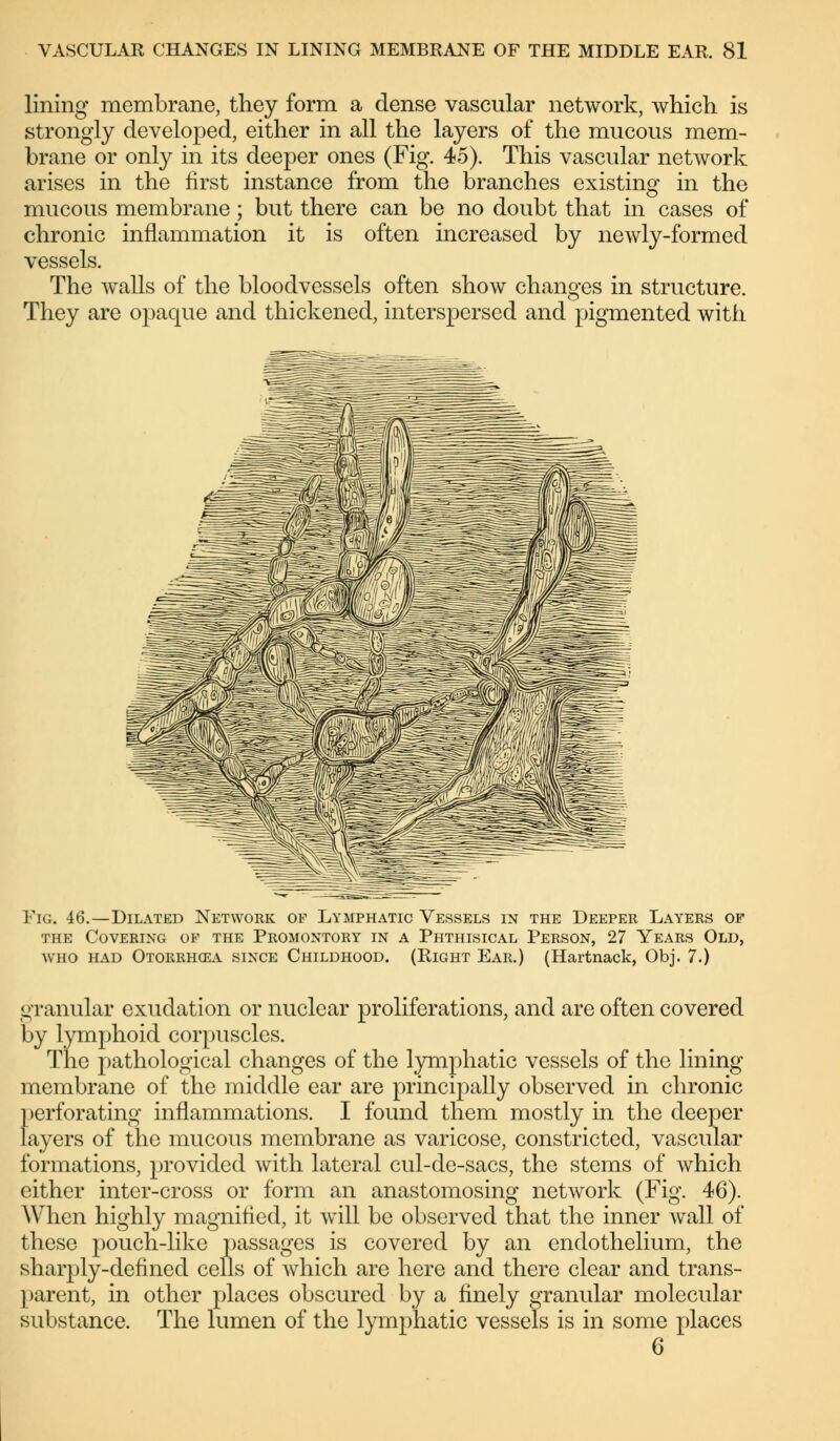 lining membrane, they form a dense vascular network, which is strongly developed, either in all the layers of the mucous mem- brane or only in its deeper ones (Fig. 45). This vascular network arises in the first instance from the branches existing in the mucous membrane; but there can be no doubt that in cases of chronic inflammation it is often increased by newly-formed vessels. The walls of the bloodvessels often show changes in structure. They are opaque and thickened, interspersed and pigmented with Fig. 46.—Dilated Network op Lymphatic Vessels in the Deeper Layers op the Covering op the Promontory in a Phthisical Person, 27 Years Old, who had Otorrhea since Childhood. (Right Ear.) (Hartnack, Obj. 7.) granular exudation or nuclear proliferations, and are often covered by lymphoid corpuscles. The pathological changes of the lymphatic vessels of the lining membrane of the middle ear are principally observed in chronic perforating inflammations. I found them mostly in the deeper layers of the mucous membrane as varicose, constricted, vascular formations, provided with lateral cul-de-sacs, the stems of which either inter-cross or form an anastomosing network (Fig. 46). When highly magnified, it will be observed that the inner wall of these pouch-like passages is covered by an endothelium, the sharply-defined cells of which are here and there clear and trans- parent, in other places obscured by a finely granular molecular substance. The lumen of the lymphatic vessels is in some places 6