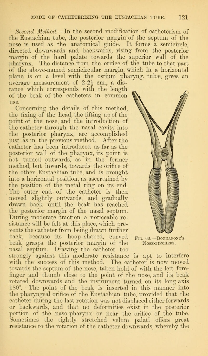 Second Method.—In the second modification of catheterism of the Eustachian tube, the posterior margin of the septum of the nose is used as the anatomical guide. It forms a semicircle, directed downwards and backwards, rising from the posterior margin of the hard palate towards the superior wall of the pharynx. The distance from the orifice of the tube to that part of the above-named semicircular margin, which in a horizontal plane is on a level with the ostium pharyng. tub«, gives an average measurement of 2-2J cm., a dis- tance which corresponds with the length of the beak of the catheters in common use. Concerning the details of this method, the fixing of the head, the lifting up of the point of the nose, and the introduction of the catheter through the nasal cavity into the posterior pharynx, are accomplished just as in the previous method. After the catheter has been introduced as far as the posterior wall of the pharynx, its point is not turned outwards, as in the former method, but inwards, towards the orifice of the other Eustachian tube, and is brouo-ht into a horizontal position, as ascertained by the position of the metal ring on its end. The outer end of the catheter is then moved slightly outwards, and gradually drawn back until the beak has reached the posterior margin of the nasal septum. During moderate traction a noticeable re- sistance will be felt at this place, which pre- vents the catheter from being drawn further back, because its hoop-shaped, curved beak grasps the posterior margin of the nasal septum. Drawing the catheter too strongly against this moderate resistance is apt to interfere with the success of this method. The catheter is now moved towards the septum of the nose, taken hold of with the left fore- tinker and thumb close to the point of the nose, and its beak rotated downwards, and the instrument turned on its long axis 180°. The point of the beak is inserted in this manner into the pharyngeal orifice of the Eustachian tube, provided that the catheter during the last rotation was not displaced either forwards or backwards, and that no deformities exist in the posterior portion of the naso-pharynx or near the orifice of the tube. Sometimes the tightly stretched velum palati offers great resistance to the rotation of the catheter downwards, whereby the Fig. 60.—Boxxafoxt's xose-pixchers.