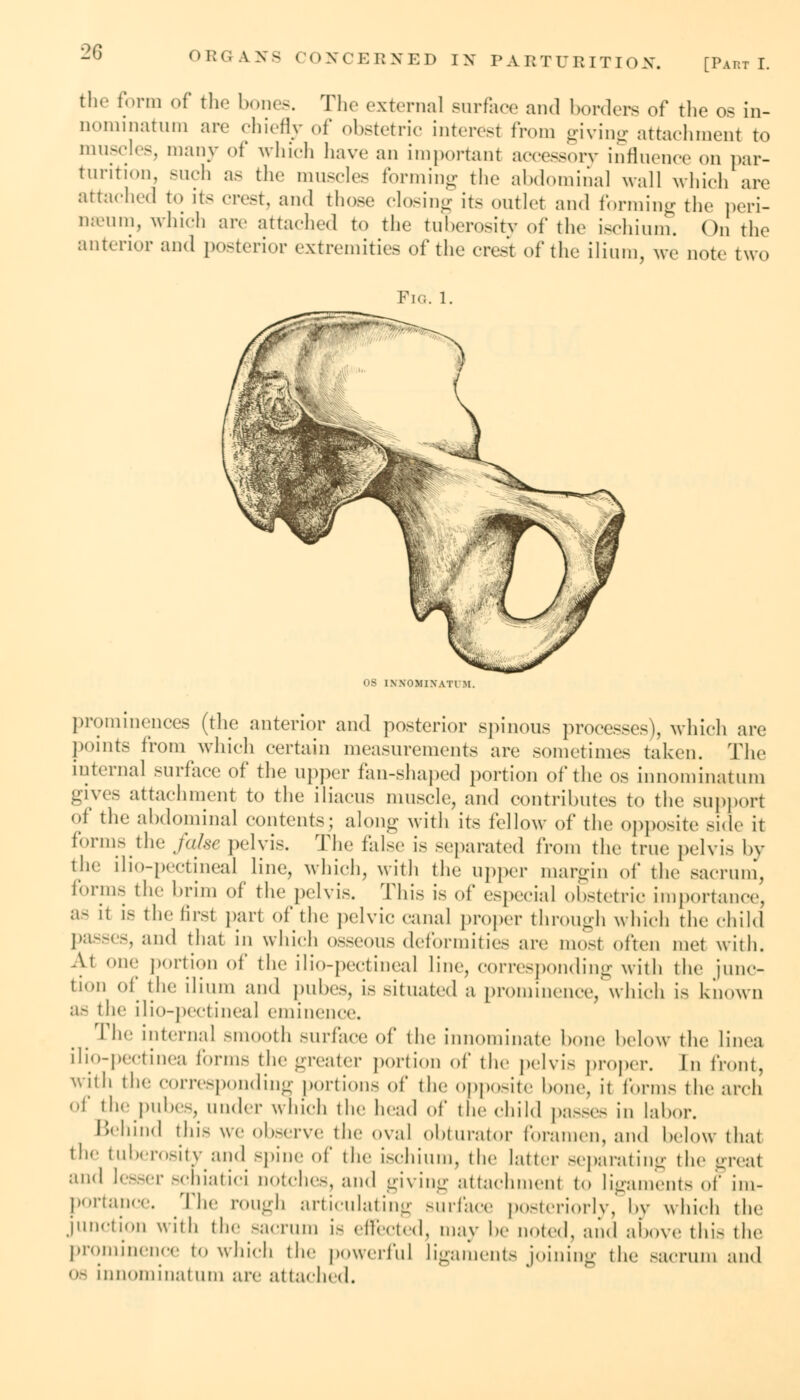 the form of the bones. The external surface and borders of the os in- nominatum are chiefly of obstetric interest from giving attachment to muscles, many of which have an important accessory influence on par- turition, such as the muscles forming the abdominal wall which are attached to its crest, and those closing its outlet and forming the peri- neum, which are attached to the tuberosity of the ischium. On the anterior and posterior extremities of the crest of the ilium, we note two Fig. 1. OS INNOMINATUM prominences (the anterior and posterior spinous processes), which are points from which certain measurements are sometimes taken. The internal surface of the upper fan-shaped portion of the OS innominatum gives attachment to the iliacus muscle, and contributes to the support of the abdominal contents; along with its fellow of the opposite side it forms the false pelvis. The false is separated from the true pelvis by the ilio-pectineal line, which, with the upper margin of the sacrum, forms the brim of the pelvis. This is of especial obstetric importance, a- it is the first part of the pelvic canal proper through which the child passes, and that in which osseous deformities are most often met with. At one portion of the ilio-pectineal line, corresponding with the junc- tion of the ilium and pubes, is situated a prominence, which is known as the ilio-pectineal eminence. t The interna! smooth surface of the innominate bone below the linea ilio-pectinea forms the greater portion of the pelvis proper. In front, wilh the corresponding portions of the opposite bone, it forms the arch Of the pubes, under which the head of the child pa8Ses in labor. Behind this we observe the oval obturator foramen, and below that the tuberosity and spine of the ischium, the latter separating the great and lesser schiatici notches, and giving attachment to ligaments of im- portance. The rough articulating surface posteriorly, by which the junction with the sacrum is effected, may be noted, and above this the prominence to which the powerful ligaments joining the sacrum and os innominatum are attached.