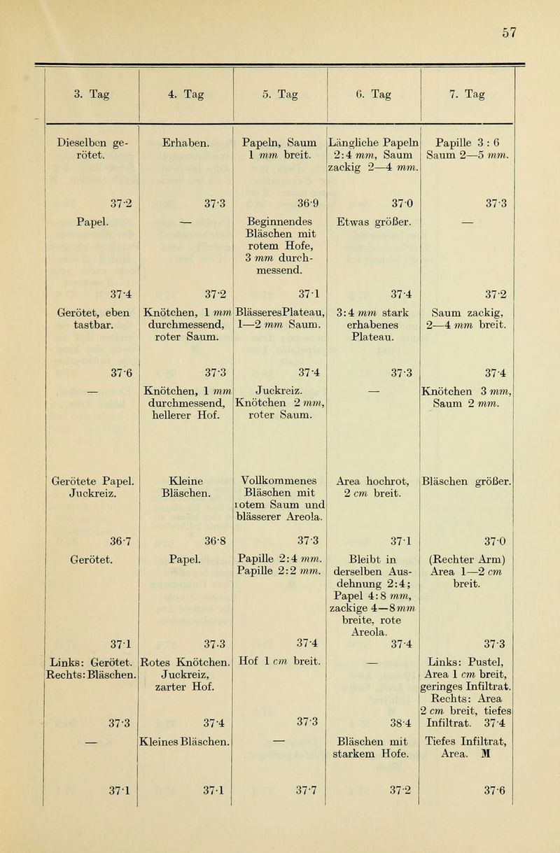 3. Tag Dieselben ge- rötet. 37 2 Papel. 37-4 Gerötet, eben tastbar. 37 6 Gerötete Papel. Juckreiz. 36-7 Gerötet. 371 Links: Gerötet. Rechts: Bläschen. 373 4. Tag Erhaben. 373 37-2 5. Tag Papeln, Saum 1 mm breit. 369 Beginnendes Bläschen mit rotem Hofe, 3 mm durch- messend. 371 Knötchen, 1 mm BlässeresPlateau, durchmessend, —2 mm Saum roter Saum. 37 3 Knötchen, 1 mm durchmessend, hellerer Hof. Kleine Bläschen. 368 Papel. 371 37-3 Rotes Knötchen. Juckreiz, zarter Hof. 37-4 Kleines Bläschen. 371 37-4 Juckreiz. Knötchen 2 mm, roter Saum. Vollkommenes Bläschen mit lotem Saum und blasserer Areola. 37 3 Papille 2:4 mm. Papille 2:2 mm. 6. Tag Längliche Papeln 2:4 mm, Saum zackig 2—4 mm 37 0 Etwas größer. 37 4 3:4 mm stark erhabenes Plateau. 373 7. Tag Papille 3 : 6 Saum 2—5 mm. 37-3 Hof 1 37-4 breit. 373 37-7 Area hochrot, 2 cm breit. 371 Bleibt in derselben Aus- dehnung 2:4; Papel 4:8 mm, zackige 4—8mm breite, rote Areola. 37-4 384 Bläschen mit starkem Hofe. 37 2 372 Saum zackig, 2—4 mm breit. 37 4 Knötchen 3 mm. Saum 2 mm. Bläschen größer. 370 (Rechter Arm) Area 1—2 cm breit. 373 Links: Pustel, Area 1 cm breit, geringes Infiltrat. Rechts: Area 2 cm breit, tiefes Infiltrat. 374 Tiefes Infiltrat, Area. M 376