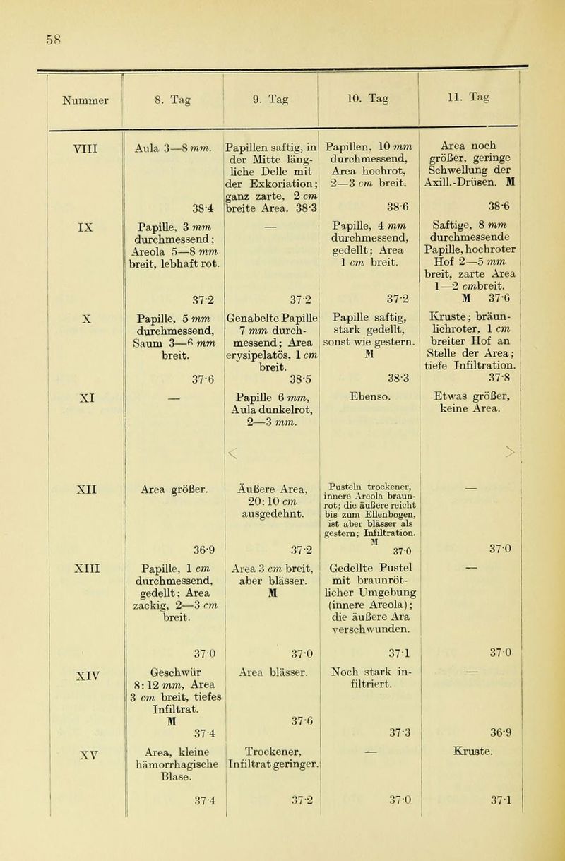 IX X XI XII XIII XIV XV Papille, 3 mm durchmessend; Areola 5—8 mm breit, lebhaft rot. 37-2 Papille, 5 mm durchmessend, Saum 3—fi mm breit. 376 9. Tag Papillen saftig, inj der Mitte läng- ] liehe Delle mit der Exkoriation; ganz zarte, 2 cm] breite Area. 38-3 10. Tag Papillen, 10 mm durchmessend, Area hochrot, 2—3 cm breit. 38-6 Papille, 4 mm durchmessend, gedellt; Area 1 cm breit. 37 2 37-2 Genabelte Papille1 Papille saftig, 7 mm durch- j stark gedellt, messend; Area sonst wie gestern, erysipelatös, lern' M breit. 38-5 38-3 Area größer. 36-9 Papille, 1 cm durchmessend, gedellt; Area zackig, 2—3 cm breit. Papille 6 mm, Aula dunkelrot, 2—3 mm. < Äußere Area, 20:10 cm ausgedehnt. 37 2 Area 3 cm breit, aber blässer. M Ebenso. 37-0 370 Geschwür < Area blässer. 8: 12 mm, Area 3 cm breit, tiefes Infiltrat. M 37'ß 37 4 Area, kleine Trockener, hämorrhagische ' Infiltrat geringer. Blase. 37 4 372 Pusteln trockener, innere Areola braun- rot; die äußere reicht bis zum Ellenbogen, iat aber blasser als gestern; Infiltration. M 37-0 Gedellte Pustel mit braunröt- licher Umgebung (innere Areola); die äußere Ära verschwunden. 37 1 Noch stark in- filtriert. 373 11. Tag Area noch größer, geringe Schwellung der Axill. -Drüsen. M 38-6 Saftige, 8 mm durchmessende Papille, hochroter Hof 2—5 mm breit, zarte Area 1—2 embreit. M 37-6 j Kruste; bräun- lichroter, 1 cm j breiter Hof an Stelle der Area; tiefe Infiltration. 37-8 | Etwas größer, keine Area. \ 370 37-0 370 369 Kruste. 371