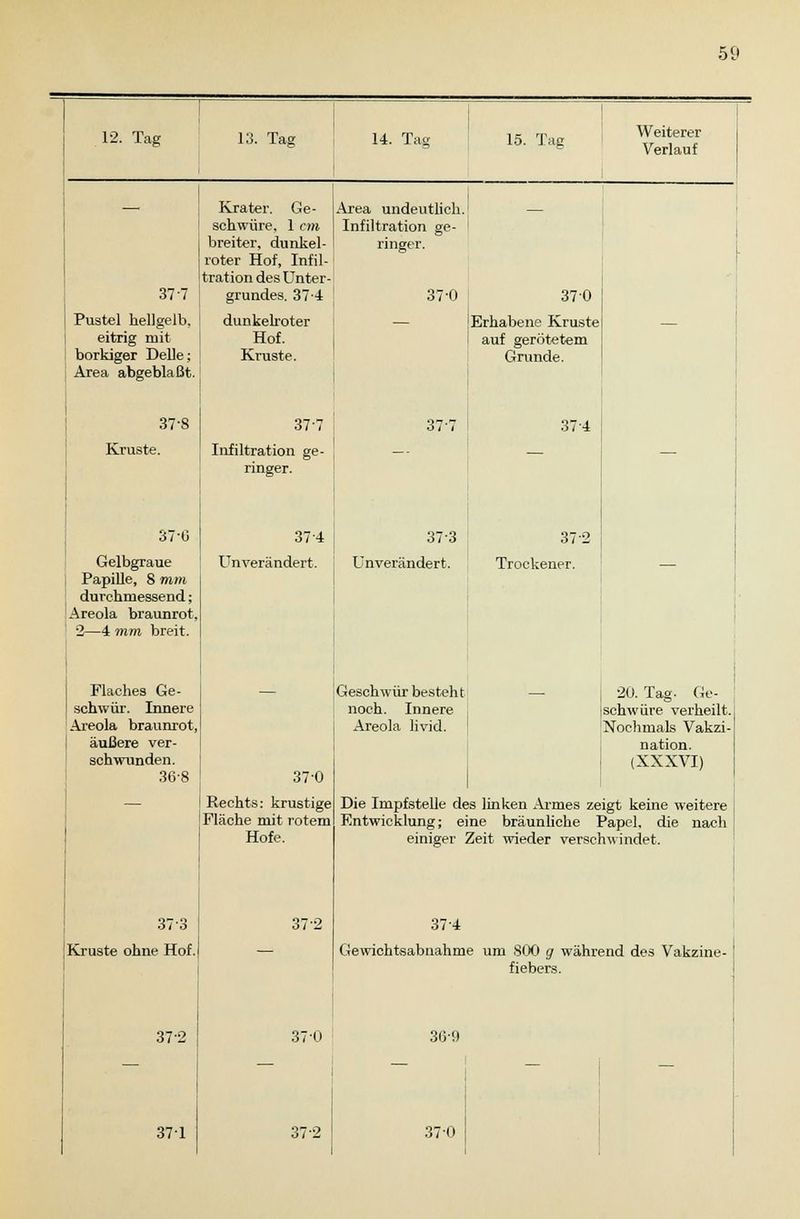 12. Tag 13. Tag 14. Tai; Weiterer Verlauf 37 7 Krater. Ge- schwüre, 1 cm breiter, dunkel- roter Hof, Infil- tration des Unter grundes. 37-4 Pustel hellgelb. ! dunkelroter eitrig mit Hof. borkiger Delle; ] Kruste. Area abgeblaßt. 37-8 Kruste. 370 Gelbgraue Papille, 8 mm durchmessend; Areola braunrot, 2—4 mm breit. Flaches Ge- schwür. Innere Areola braunrot, äußere ver- schwunden. 36-8 Area undeutlich.1 Infiltration ge- ' ringer. 37-0 37-7 Infiltration ge- ringer. 374 Unverändert. 37-7 370 Erhabene Kruste auf gerötetem Grunde. 374 373 Kruste ohne Hof. 372 370 Rechts: krustige Fläche mit rotem Hofe. 372 37-3 unverändert. 37 2 Trockener. Geschwür besteht noch. Innere Areola livid. 20. Tag- Ge- schwüre verheilt. Nochmals Vakzi- nation. (XXXVI) 371 37-0 372 Die Impfstelle des linken Armes zeigt keine weitere Entwicklung; eine bräunliche Papel, die nach einiger Zeit wieder verschwindet. 37-4 Gewichtsabnahme um 800 g während des Vakzine- fiebers. 36-9 37-0