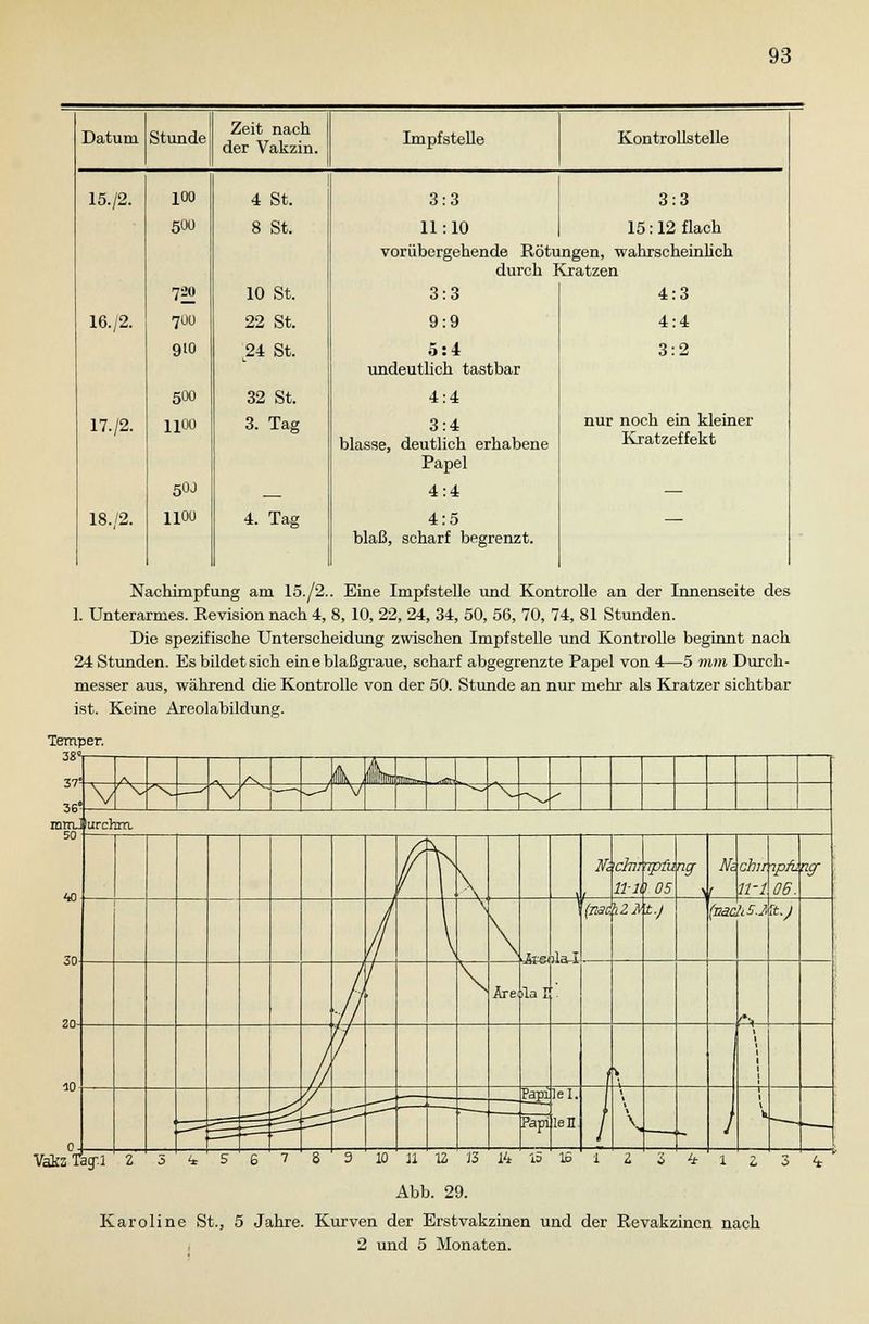Datum Stunde 15./2. 100 500 720 16./2. 700 910 500 17./2. lioo 50J 18./2. lioo Zeit nach der Vakzin. Impfstelle Kontrollstelle 4 St. 8 St. 10 St. 22 St. 24 St. 32 St. 3. Tag 4. Tag 3:3 11:10 3:3 15: 12 flach vorübergehende Rötungen, wahrscheinlich durch Kratzen 4:3 4:4 3:2 nur noch ein kleiner Kratzeffekt 3:3 9:9 5:4 undeutlich tastbar 4:4 3:4 blasse, deutlich erhabene Papel 4:4 4:5 blaß, scharf begrenzt. Nachimpfung am 15./2.. Eine Impfstelle und Kontrolle an der Innenseite des 1. Unterarmes. Revision nach 4, 8, 10, 22, 24, 34, 50, 56, 70, 74, 81 Stunden. Die spezifische Unterscheidung zwischen Impfstelle und Kontrolle beginnt nach 24 Stunden. Es bildet sich eine blaßgraue, scharf abgegrenzte Papel von 4—5 mm Durch- messer aus, während die Kontrolle von der 50. Stunde an nur mehr als Kratzer sichtbar ist. Keine Areolabildung. 4 1 Z 3 ^ VakaTagu ' Z 5 <* 5 6 ~> ' 8 3 10 il 12 13 14 15 15 1 Z Abb. 29. Karoline St., 5 Jahre. Kurven der Erstvakzinen und der Revakzincn nach 2 und 5 Monaten.