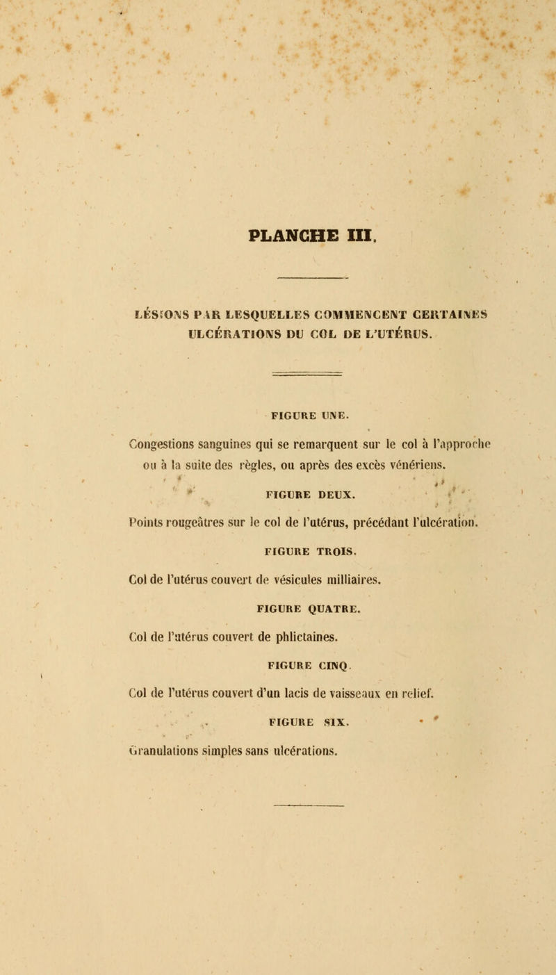 LÉS.'ONS PAR LESQUELLES COMMENCENT CERTAINES ULCÉRATIONS DU COL DE L'UTÉRUS. FIGURE UNE. Congestions sanguines qui se remarquent sur le col à l'approche ou à la suite des règles, ou après des excès vénériens. ,> FIGURE DEUX. Points rougeâtres sur le col de l'utérus, précédant l'ulcération. FIGURE TROIS. Col de l'utérus couvert de vésicules milliaires. FIGURE QUATRE. Col de l'utérus couvert de phlictaines. FIGURE CINQ. Col de l'utérus couvert d'un lacis de vaisseaux en relief. FIGURE SIX. Granulations simples sans ulcérations.