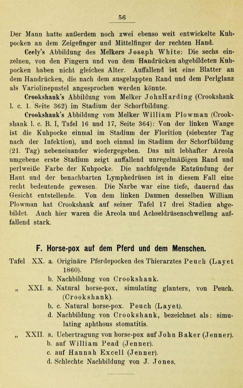 Der Mann hatte außerdem noch zwei ebenso weit entwickelte Kuh- pocken an dem Zeigefinger und Mittelfinger der rechten Hand. Ceely's Abbildung des Melkers Joseph White: Die sechs ein- zelnen, von den Fingern und von dem Handrücken abgebildeten Kuh- pocken haben nicht gleiches Alter. Auffallend ist eine Blatter an dem Handrücken, die nach dem ausgelappten Rand und dem Perlglanz als Variolinepustel angesprochen werden könnte. Crookshank's Abbildung vom Melker JohnHarding (Crookshank 1. c. 1. Seite 362) im Stadium der Schorfbildung. Crookshank's Abbildung vom Melker William Plowman (Crook- shank 1. c. B. I, Tafel 16 und 17, Seite 364): Von der linken Wange ist die Kuhpocke einmal im Stadium der Florition (siebenter Tag nach der Infektion), und noch einmal im Stadium der Schorfbildung (21. Tag) nebeneinander wiedergegeben. Das mit lebhafter Areola umgebene erste Stadium zeigt auffallend unregelmäßigen Rand und perlweiße Farbe der Kuhpocke. Die nachfolgende Entzündung der Haut und der benachbarten Lymphedrüsen ist in diesem Fall eine recht bedeutende gewesen. Die Narbe war eine tiefe, dauernd das Gesicht entstellende. Von dem linken Daumen desselben William Plowman hat Crookshank auf seiner Tafel 17 drei Stadien abge- bildet. Auch hier waren die Areola und Achseldrüsenschwellimg auf- fallend stark. F. Horse-pox auf dem Pferd und dem Menschen. Tafel XX. a. Originäre Pferdepocken des Thierarztes Peuch (Layet 1860). b. Nachbildung von Crookshank. „ XXI. a. Natural horse-pox, simulating glanters, von Peuch. (Crookshank). b. c. Natural horse-pox. Peuch (Layet). d. Nachbildung von Crookshank, bezeichnet als: simu- lating aphthous Stomatitis. „ XXII. a. Uebertragung von horse-pox auf John Baker (Jenner). b. auf William Pead (Jenner). c. auf Hannah Excell (Jenner). d. Schlechte Nachbildung von J. Jones.