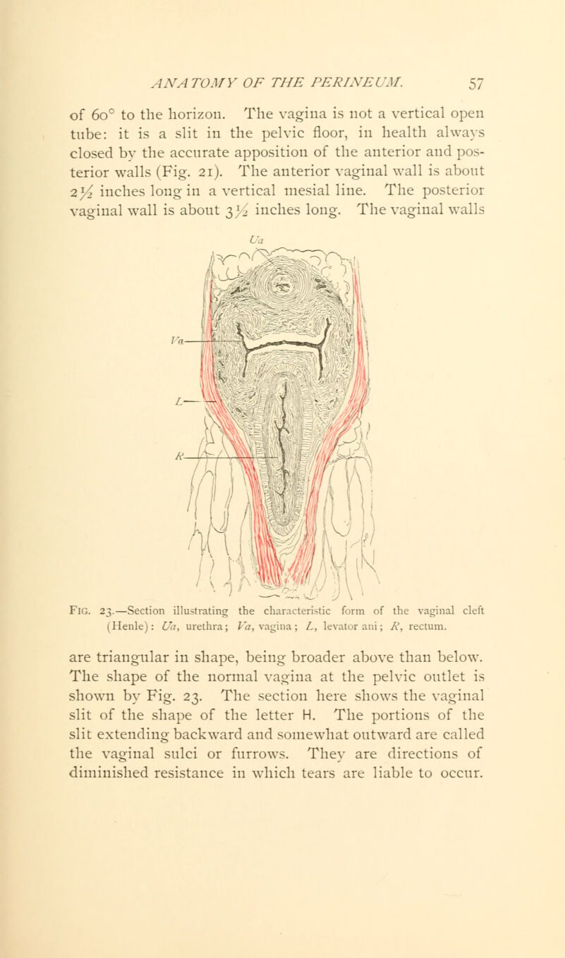 of 6o° to the horizon. The vagina is not a vertical open tube: it is a slit in the pelvic floor, in health always closed by the accurate apposition of the anterior and pos- terior walls (Fig. 21). The anterior vaginal wall is about 21/2 inches long in a vertical mesial line. The posterior vaginal wall is about 3^ inches long. The vaginal walls Fig. 23.—Section illustrating the characteristic form of the vaginal cleft (Henle): Ua, urethra; Va, vagina; L, levator ani; A', rectum. are triangular in shape, being broader above than below. The shape of the normal vagina at the pelvic outlet is shown by Fig. 23. The section here shows the vaginal slit of the shape of the letter H. The portions of the slit extending backward and somewhat outward are called the vaginal sulci or furrows. They are directions of diminished resistance in which tears are liable to occur.