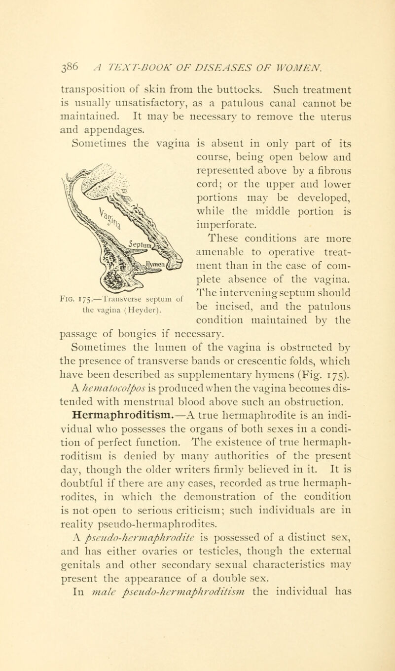 Sometimes the Fig. 75.— Transverse septum of the vagina (Heyder). transposition of skin from the buttocks. Such treatment is usually unsatisfactory, as a patulous canal cannot be maintained. It may be necessary to remove the uterus and appendages. is absent in only part of its course, being open below and represented above by a fibrous cord; or the upper and lower portions may be developed, while the middle portion is imperforate. These conditions are more amenable to operative treat- ment than in the case of com- plete absence of the vagina. The intervening septum should be incised, and the patulous condition maintained by the passage of bougies if necessary. Sometimes the lumen of the vagina is obstructed by the presence of transverse bands or crescentic folds, which have been described as supplementary hymens (Fig. 175). A hematocolpos is produced when the vagina becomes dis- tended with menstrual blood above such an obstruction. Hermaphroditism.—A true hermaphrodite is an indi- vidual who possesses the organs of both sexes in a condi- tion of perfect function. The existence of true hermaph- roditism is denied by many authorities of the present day, though the older writers firmly believed in it. It is doubtful if there are any cases, recorded as true hermaph- rodites, in which the demonstration of the condition is not open to serious criticism; such individuals are in reality pseudo-hermaphrodites. A pseudo-hermaphrodite is possessed of a distinct sex, and has either ovaries or testicles, though the external genitals and other secondarv sexual characteristics may present the appearance of a double sex. In male pseudohermaphroditism the individual has