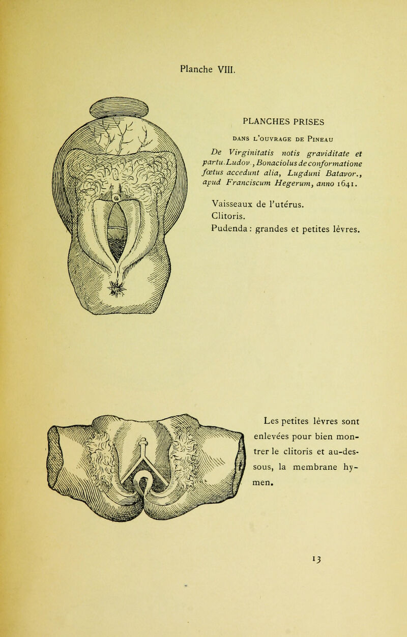 PLANCHES PRISES DANS L'OUVRAGE DE PlNEAU De Virginitatis notis graviditate et partu.Ludov , Bonaciolusdeconformatione foetus accedunt alla, Lugduni Batavor., apud Franciscum Hegerum, anno 1641. Vaisseaux de l'ute'rus. Clitoris. Pudenda : grandes et petites lèvres. Les petites lèvres sont enlevées pour bien mon- trer le clitoris et au-des- sous, la membrane hy- men. •3