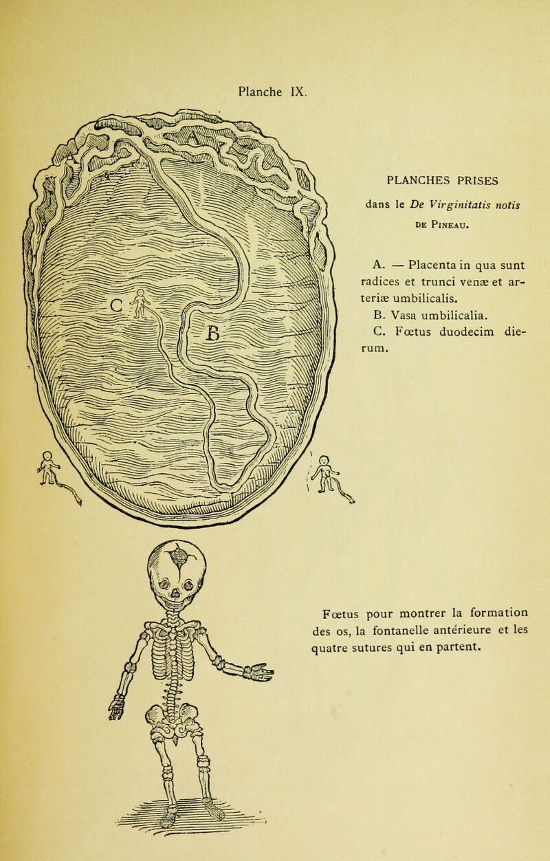 PLANCHES PRISES dans le De Virginitatis notis de Pineau. A. — Placenta in qua sunt radices et trunci venas et ar- teriae umbilicalis. B. Vasa umbilicalia. C. Fœtus duodecim die- rum. Fœtus pour montrer la formation des os, la fontanelle antérieure et les quatre sutures qui en partent.