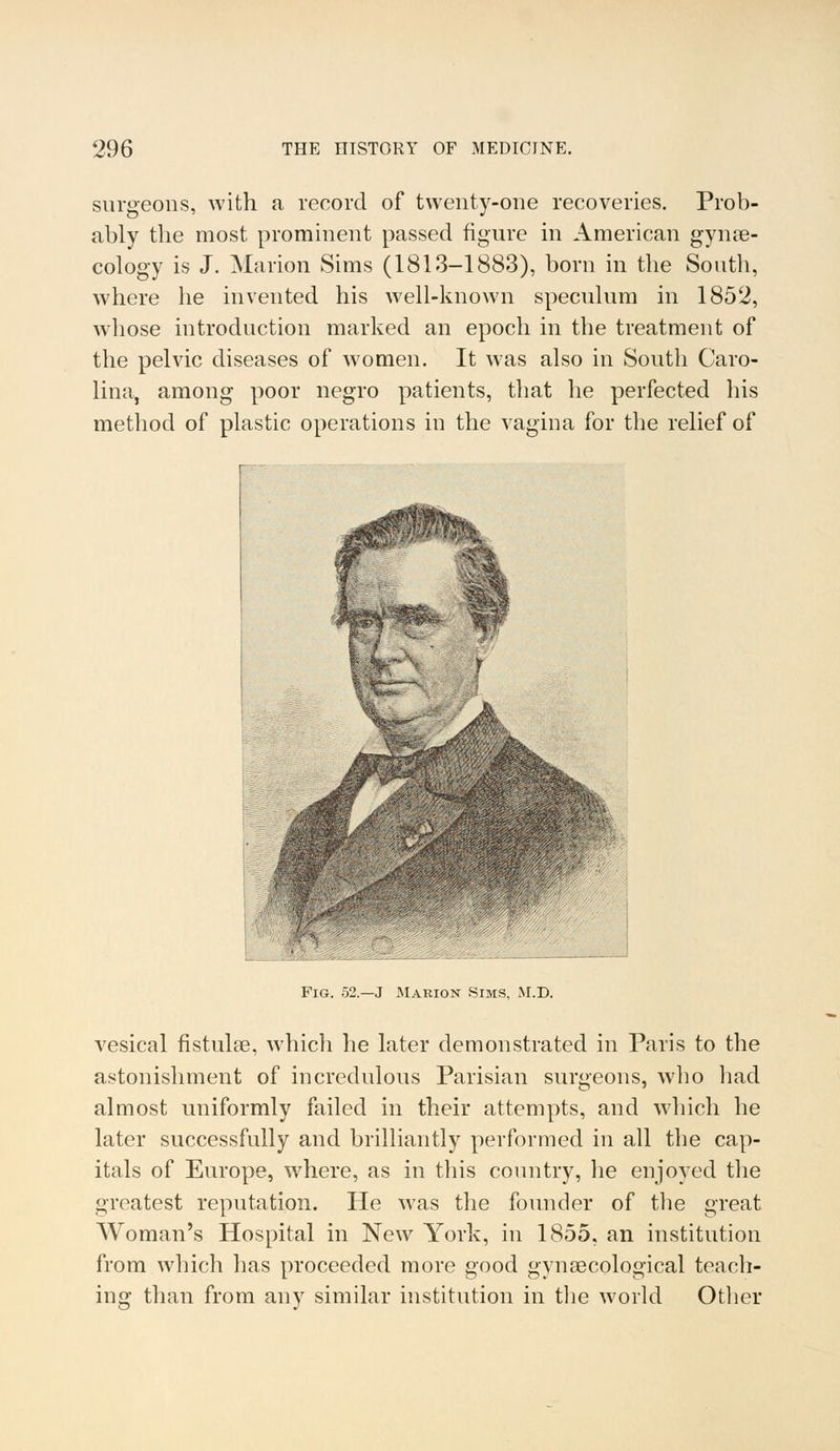 surgeons, with a record of twenty-one recoveries. Prob- ably the most prominent passed figure in American gynae- cology is J. Marion Sims (1813-1883), born in the South, where he invented his well-known speculum in 1852, whose introduction marked an epoch in the treatment of the pelvic diseases of women. It was also in South Caro- lina, among poor negro patients, that he perfected his method of plastic operations in the vagina for the relief of Fig. 52—J Marion Sims, M.D. vesical fistulee, which he later demonstrated in Paris to the astonishment of incredulous Parisian surgeons, who had almost uniformly failed in their attempts, and winch he later successfully and brilliantly performed in all the cap- itals of Europe, where, as in this country, he enjoyed the greatest reputation. He was the founder of the great Woman's Hospital in New York, in 1855, an institution from which has proceeded more good gynaecological teach- ing than from any similar institution in the world Other