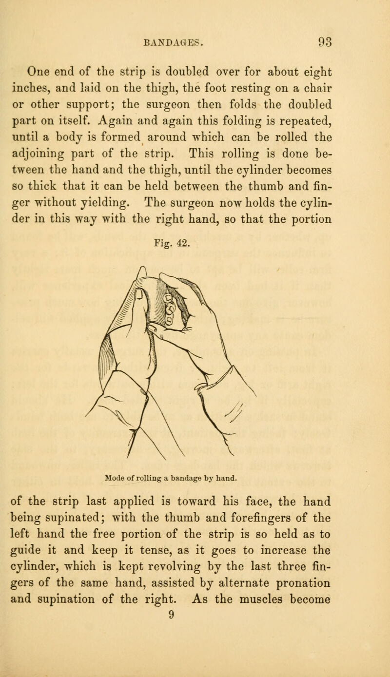 One end of the strip is doubled over for about eight inches, and laid on the thigh, the foot resting on a chair or other support; the surgeon then folds the doubled part on itself. Again and again this folding is repeated, until a body is formed around which can be rolled the adjoining part of the strip. This rolling is done be- tween the hand and the thigh, until the cylinder becomes so thick that it can be held between the thumb and fin- ger without yielding. The surgeon now holds the cylin- der in this way with the right hand, so that the portion Fig. 42. Mode of rolling a bandage by hand. of the strip last applied is toward his face, the hand being supinated; with the thumb and forefingers of the left hand the free portion of the strip is so held as to guide it and keep it tense, as it goes to increase the cylinder, which is kept revolving by the last three fin- gers of the same hand, assisted by alternate pronation and supination of the right. As the muscles become 9