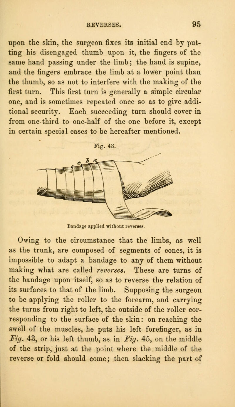 upon the skin, the surgeon fixes its initial end by put- ting his disengaged thumb upon it, the fingers of the same hand passing under the limb; the hand is supine, and the fingers embrace the limb at a lower point than the thumb, so as not to interfere with the making of the first turn. This first turn is generally a simple circular one, and is sometimes repeated once so as to give addi- tional security. Each succeeding turn should cover in from one-third to one-half of the one before it, except in certain special cases to be hereafter mentioned. Fig. 43. Bandage applied without reverses. Owing to the circumstance that the limbs, as well as the trunk, are composed of segments of cones, it is impossible to adapt a bandage to any of them without making what are called reverses. These are turns of the bandage upon itself, so as to reverse the relation of its surfaces to that of the limb. Supposing the surgeon to be applying the roller to the forearm, and carrying the turns from right to left, the outside of the roller cor- responding to the surface of the skin: on reaching the swell of the muscles, he puts his left forefinger, as in Fig. 43, or his left thumb, as in Fig. 45, on the middle of the strip, just at the point where the middle of the reverse or fold should come; then slacking the part of