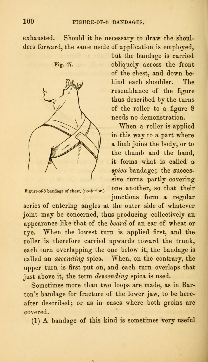 exhausted. Should it be necessary to draw the shoul- ders forward, the same mode of application is employed, but the bandage is carried Fig. 47. obliquely across the front of the chest, and down be- hind each shoulder. The resemblance of the figure thus described by the turns of the roller to a figure 8 needs no demonstration. When a roller is applied in this way to a part where a limb joins the body, or to the thumb and the hand, it forms what is called a spica bandage; the succes- sive turns partly covering one another, so that their junctions form a regular series of entering angles at the outer side of whatever joint may be concerned, thus producing collectively an appearance like that of the beard of an ear of wheat or rye. When the lowest turn is applied first, and the roller is therefore carried upwards toward the trunk, each turn overlapping the one below it, the bandage is called an ascending spica. When, on the contrary, the upper turn is first put on, and each turn overlaps that just above it, the term descending spica is used. Sometimes more than two loops are made, as in Bar- ton's bandage for fracture of the lower jaw, to be here- after described; or as in cases where both groins are covered. (1) A bandage of this kind is sometimes very useful Figure-of-8 bandage of chest, (posterior.)