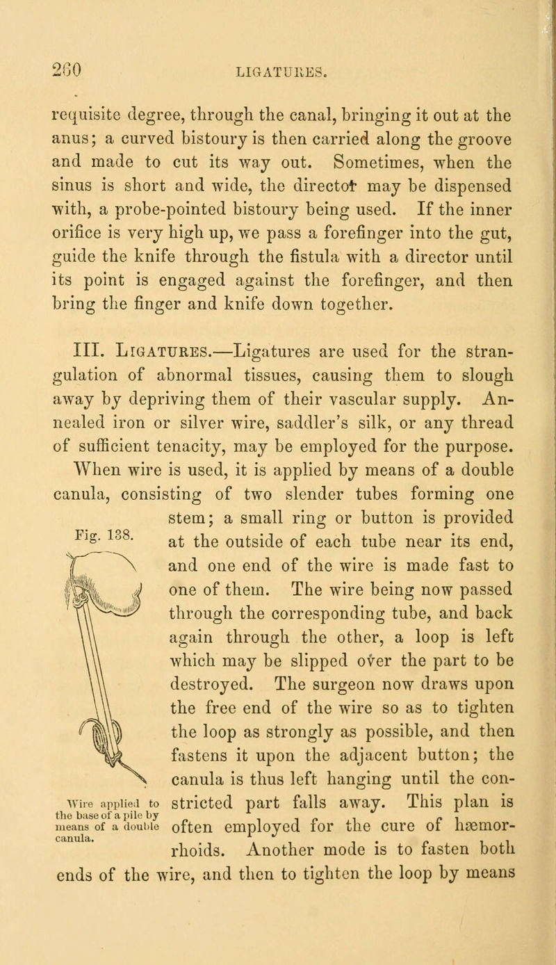 requisite degree, through the canal, bringing it out at the anus; a curved bistoury is then carried along the groove and made to cut its way out. Sometimes, when the sinus is short and wide, the director may be dispensed with, a probe-pointed bistoury being used. If the inner orifice is very high up, we pass a forefinger into the gut, guide the knife through the fistula with a director until its point is engaged against the forefinger, and then bring the finger and knife down together. Fig. 13$ III. Ligatures.—Ligatures are used for the stran- gulation of abnormal tissues, causing them to slough away by depriving them of their vascular supply. An- nealed iron or silver wire, saddler's silk, or any thread of sufficient tenacity, may be employed for the purpose. When wire is used, it is applied by means of a double canula, consisting of two slender tubes forming one stem; a small ring or button is provided at the outside of each tube near its end, and one end of the wire is made fast to one of them. The wire being now passed through the corresponding tube, and back again through the other, a loop is left which may be slipped over the part to be destroyed. The surgeon now draws upon the free end of the wire so as to tighten the loop as strongly as possible, and then fastens it upon the adjacent button; the canula is thus left hanging until the con- wire applied to stricted part falls away. This plan is the base of a pile by . means of a double often employed lor the cure 01 nsemor- canula. *~ . . . rhoids. Another mode is to fasten both ends of the wire, and then to tighten the loop by means