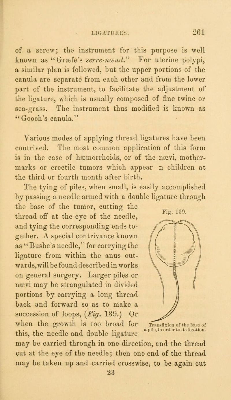 of a screw; the instrument for this purpose is well known as Graefe's serre-noe.ud. For uterine polypi, a similar plan is followed, but the upper portions of the canula are separate from each other and from the lower part of the instrument, to facilitate the adjustment of the ligature, which is usually composed of fine twine or sea-grass. The instrument thus modified is known as Gooch's canula. Fig. 139. Various modes of applying thread ligatures have been contrived. The most common application of this form is in the case of haemorrhoids, or of the noevi, mother- marks or erectile tumors which appear n children at the third or fourth month after birth. The tying of piles, when small, is easily accomplished by passing a needle armed with a double ligature through the base of the tumor, cutting the thread off at the eye of the needle, and tying the corresponding ends to- gether. A special contrivance known as Bushe's needle, for carrying the ligature from within the anus out- wards, will be found described in works on general surgery. Larger piles or naevi may be strangulated in divided portions by carrying a long thread back and forward so as to make a succession of loops, (Fig. 139.) Or when the growth is too broad for this, the needle and double ligature may be carried through in one direction, and the thread cut at the eye of the needle; then one end of the thread may be taken up and carried crosswise, to be again cut 23 Transfixion of the base of pile, in order to its ligation.