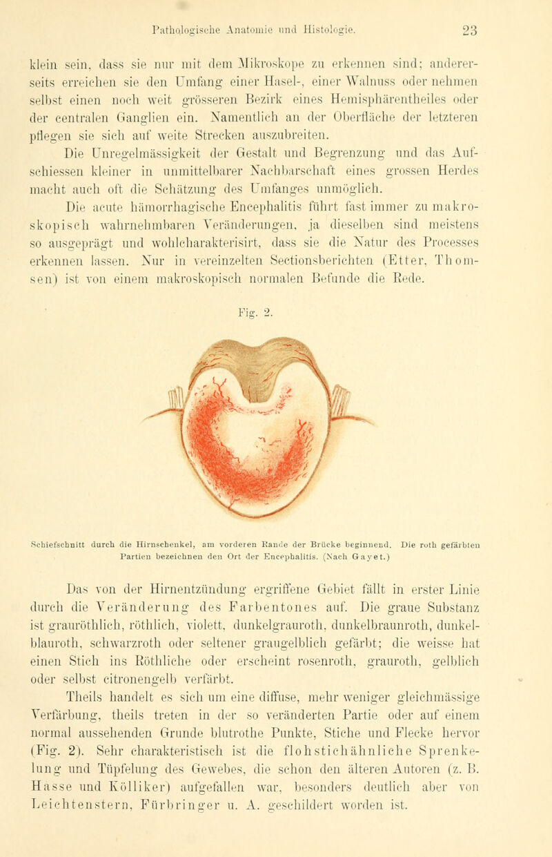 klein sein, dass sie nur mit dem Mikroskope zu erkennen sind; anderer- seits erreichen sie den Umfang einer Hasel-, einer Walnuss oder nehmen selbst einen noch weit grösseren Bezirk eines Hemisphärentheiles oder der centralen Ganglien ein. Namentlich an der Oberfläche der letzteren pflegen sie sich auf weite Strecken auszubreiten. Die Unregelmässigkeit der Gestalt und Begrenzung und das Auf- schiessen kleiner in unmittelbarer Nachbarschaft eines grossen Herdes macht auch oft die Schätzung des Umfanges unmöglich. Die acute hämorrhagische Encephalitis führt fast immer zu makro- skopisch wahrnehmbaren Veränderungen, ja dieselben sind meistens so ausgeprägt und wohlcharakterisirt, dass sie die Natur des Processes erkennen lassen. Nur in vereinzelten Sectionsberichten (Etter, Thom- sen) ist von einem makroskopisch normalen Befunde die Eede. Fig. 2. Schiefschnitt durch die Hirnschenkel, am vorderen Rande der Brücke beginnend. Die roth gefärbten Partien bezeichnen den Ort der Encephalitis. (Nach Gay et.) Das von der Hirnentzündung ergriffene Gebiet fällt in erster Linie durch die Veränderung des Farbentones auf. Die graue Substanz ist grauröthlich, röthlich, violett, dunkelgrauroth, dunkelbraunroth, dunkel- blauroth, schwarzroth oder seltener graugelblich gefärbt; die weisse hat einen Stich ins Bothliche oder erscheint rosenroth, grauroth, gelblich oder selbst citronengelb verfärbt. Theils handelt es sich um eine diffuse, mehr weniger gleichmässige Verfärbung, theils treten in der so veränderten Partie oder auf einem normal aussehenden Grunde blutrothe Punkte, Stiche und Flecke hervor (Fig. 2). Sehr charakteristisch ist die flohstichähnliche Sprenke- lung und Tüpfelung des Gewebes, die schon den älteren Autoren (z.B. Hasse und Kölliker) aufgefallen war, besonders deutlich aber von Leichtenstern, Fürbringer u. A. geschildert worden ist.