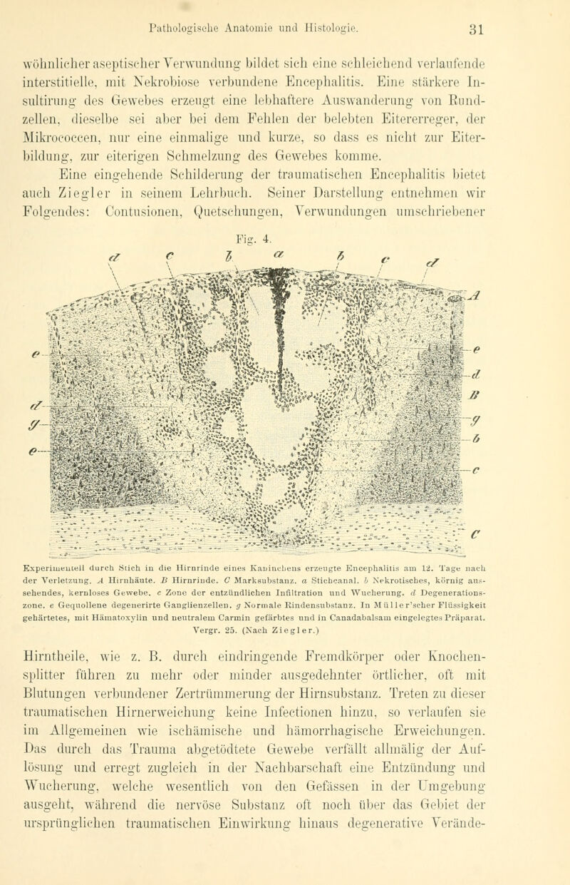 wohnlicher aseptischer Verwundung bildet sich eine schleichend verlaufende interstitielle, mit Nekrobiose verbundene Encephalitis. Eine stärkere In- sultirung des Gewebes erzeugt eine lebhaftere Auswanderung von Rund- zellen, dieselbe sei aber bei dem Fehlen der belebten Eitererreger, der Mikrococcen, nur eine einmalige und kurze, so class es nicht zur Eiter- bildung, zur eiterigen Schmelzung des Gewebes komme. Eine eingehende Schilderung der traumatischen Encephalitis bietet auch Ziegler in seinem Lehrbuch. Seiner Darstellung entnehmen wir Folgendes: Contusionen, Quetschungen, Verwundungen umschriebener Fig. 4. •«I e ä>*s* -,9 —c '^iV■■:'■ ■''->' J\ >, ■ > *'i •■•■■ayAV». „>*•'♦(>''' ■ ' /5 !fM ■>.-.- •»'.-*-■ -■ ' ' - -* ■  ■» Zi-r? * ,CT5k F'v-i. tv-4 -;->,-•> >>.-. ■,. ■•■.»■., .4 ' ':;\v\t*V*V,f^ - • '' • .■,.*....:.^äsv^^-.'-. Experiuieuteü durch Stich in die Hirnrinde eines Kaninchens erzeugte Encephalitis am 12. Tage nach der Verletzung. A Hirnhäute. B Hirnrinde. C Marksubstanz, a Sticheanal, b Nekrotisches, körnig aus- sehendes, kernloses Gewebe, c Zone der entzündlichen Infiltration und Wucherung, d Degenerations- zone, e Gequollene degenerirte Ganglienzellen, g Normale Rindensubstanz. In Müller'scher Flüssigkeit gehärtetes, mit Hämatoxylin und neutralem Carmin gefärbtes und in Canadabalsam eingelegtes Präparat. Vergr. 25. (Nach Ziegler.) Hirntheile, wie z. B. durch eindringende Fremdkörper oder Knochen- splitter führen zu mehr oder minder ausgedehnter örtlicher, oft mit Blutungen verbundener Zertrümmerung der Hirnsubstanz. Treten zu dieser traumatischen Hirnerweichung keine Infectionen hinzu, so verlaufen sie im Allgemeinen wie ischämische und hämorrhagische Erweichungen. Das durch das Trauma abgetöcltete Gewebe verfällt allmälig der Auf- lösung und erregt zugleich in der Nachbarschaft eine Entzündung und Wucherung, welche wesentlich von den Gefässen in der Umgebung- ausgeht, während die nervöse Substanz oft noch über das Gebiet der ursprünglichen traumatischen Einwirkung hinaus degenerative Verände-