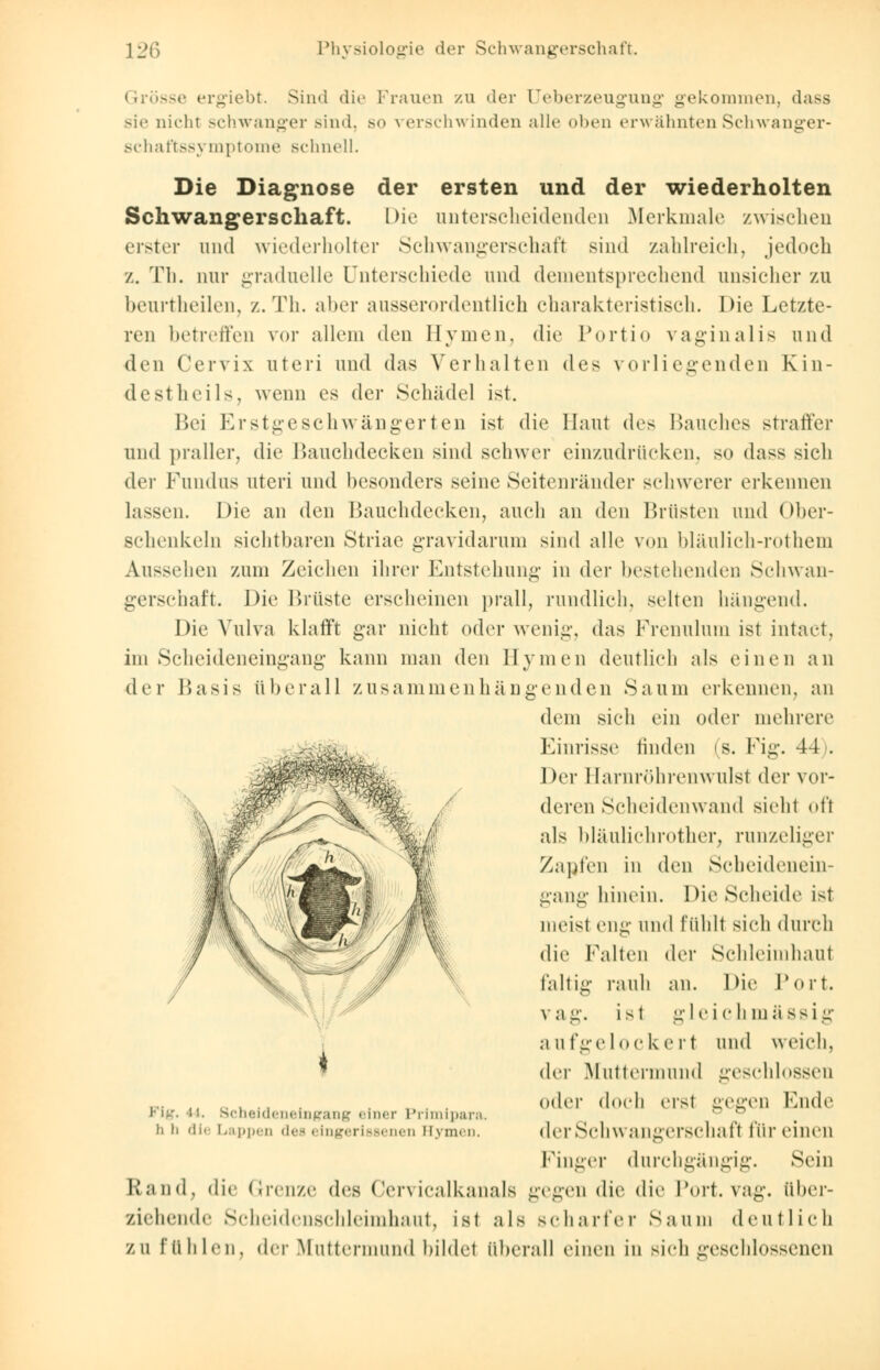 Grösse ergiebt. Sinti die Frauen zu der (Jeberzeugung gekommen, dass sie nicht schwanger Bind, so verschwinden alle oben erwähnten Schwanger- schaftssymptome schnell. Die Diagnose der ersten und der wiederholten Schwangerschaft. Die unterscheidenden Merkmale /.wischen erster und wiederholter Schwangerschaft sind zahlreich, jedoch /.. Th. nur graduelle Unterschiede und dementsprechend unsicher zu beurtheilen, z.Th. aber ausserordentlich charakteristisch. Die Letzte- ren betreffen vor allem den Hymen, die Portio vaginalis und den Cervix uteri und das Verhalten des vorliegenden Kin- destheils, wenn es der Schädel ist. Bei Erstgeschwängerten ist die Haut des Hauches straffer und praller, die Bauchdecken sind schwer einzudrücken, so dass sich der Fundus uteri und besonders seine Seitenränder schwerer erkennen lassen. Die an den Bauchdecken, auch an den Brüsten und Ober- schenkeln sichtbaren Striae gravidarum sind alle von bläulich-rothem Aussehen zum Zeichen ihrer Entstehung in der bestehenden Schwan- gerschaft. Die Brüste erscheinen prall, rundlich, selten hängend. Die Vulva klafft gar nicht oder wenig, das Frenulum ist intact, im Scheideneingang kann man den Hymen deutlich als einen an der Basis überall zusammenhängenden Saum erkennen, an dem sich ein oder mehrere Einrisse linden < s. Fig. 41 . Der Harnröhrenwulst der vor- deren Scheidenwand sieht oft als bläulichrother, runzeliger Zapfen in den Scheidenein- gang hinein. Die Scheide ist nieist eng und fühlt sieh dureli die Falten der Schleimhaut faltig rauh an. Die Port. vag. ist gl eich massig aufgelockert und weich, der Muttermund geschlossen oder doch eist -cgen Faule Fig. n. Scheideneingang einer Prlmipan h li di< Lappen des eingerissenen Hymen. der Schwangerschaft für einen Fin -er Rand, die Grenze des Cervicalkanals durchgan reffen die die Tort, va; Sein aber- ziehende Scheidenschleimhaut, ist als scharfer Saum deutlich ZU fühlen, der Muttermund bildet überall einen in sich geschlossenen