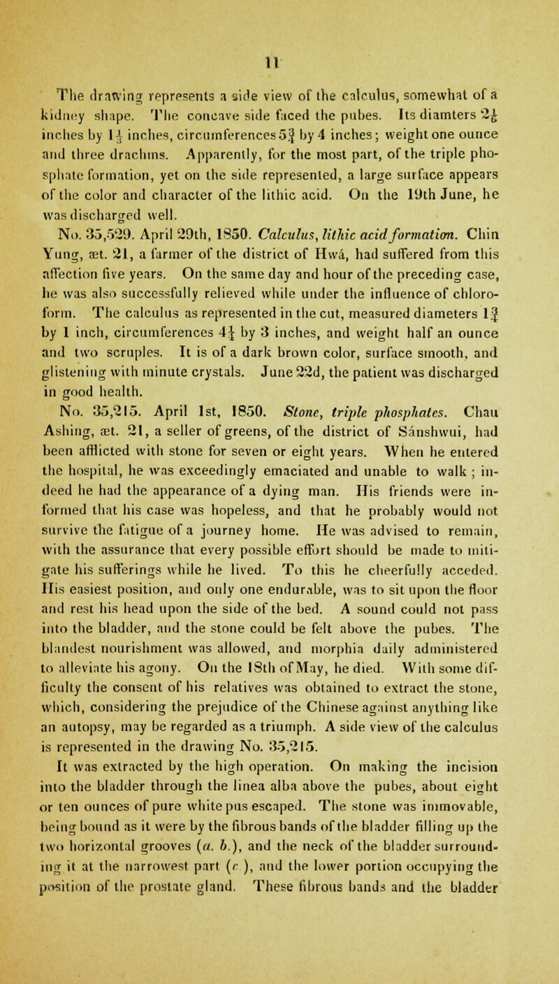 The drntvincr represents a side view of the calculus, somewhat of a kidney shape. The concave side facerl the pubes. Its diamters 2£ inches by 1^ inches, circumferences 5J by 4 inches; weight one ounce and three drachms. Apparently, for the most part, of the triple pho- sphate formation, yet on the side represented, a large surface appears of the color and character of the lithic acid. On the 19th June, he was discharged well. No. 35,529. April 29th, 1850. Calculus, lithic acid formation. Chin Yung, set. 21, a farmer of the district of Hwa, had suffered from this affection five years. On the same day and hour of the preceding case, he was also successfully relieved while under the influence of chloro- form. The calculus as represented in the cut, measured diameters 1J by 1 inch, circumferences 4J by 3 inches, and weight half an ounce and two scruples. It is of a dark brown color, surface smooth, and glistening with minute crystals. June 22d, the patient was discharged in good health. No. 35,215. April 1st, 1850. Stone, triple phosphates. Chau Ashing, a3t. 21, a seller of greens, of the district of Sanshwui, had been afflicted with stone for seven or eight years. When he entered the hospital, he was exceedingly emaciated and unable to walk ; in- deed he had the appearance of a dying man. His friends were in- formed that his case was hopeless, and that he probably would not survive the fatigue of a journey home. He was advised to remain, with the assurance that every possible effort should be made to miti- gate his sufferings while he lived. To this he cheerfully acceded. His easiest position, and only one endurable, was to sit upon the floor and rest his head upon the side of the bed. A sound could not pass into the bladder, and the stone could be felt above the pubes. The blandest nourishment was allowed, and morphia daily administered to alleviate his agony. On the 18th of May, he died. With some dif- ficulty the consent of his relatives was obtained to extract the stone, which, considering the prejudice of the Chinese against anything like an autopsy, may be regarded as a triumph. A side view of the calculus is represented in the drawing No. 35,215. It was extracted by the high operation. On making the incision into the bladder through the linea alba above the pubes, about eight or ten ounces of pure white pus escaped. The stone was immovable, being bound as it were by the fibrous bands of the bladder filling up the two horizontal grooves (a. b.), and the neck of the bladder surround- ing it at the narrowest part (r ), and the lower portion occupying the position of the prostate gland. These fibrous bands and the bladder