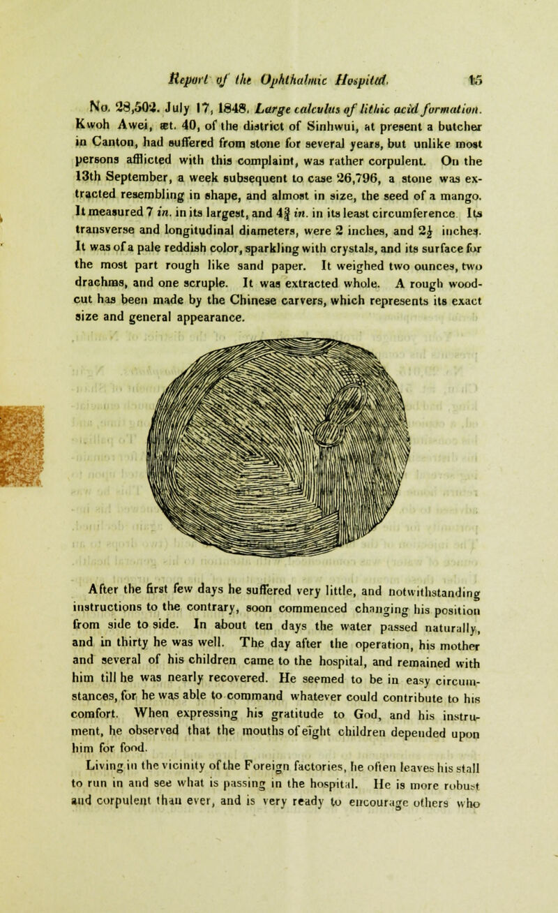 ■■ No. 28,502. July 17, 1848, Large calculus of lithic acid formation. Kwoh Awei, an. 40, of the district of Sinhwui, at present a butcher in Canton, had suffered from stone for several years, but unlike most persons afflicted with this complaint, was rather corpulent. On the 13th September, a week subsequent to case 26,796, a stone was ex- tracted resembling in shape, and almost in size, the seed of a mango. It measured 7 in. in its largest, and 4| in. in its least circumference Its transverse and longitudinal diameters, were 2 inches, and 2J inches It was of a pale reddish color, sparkling with crystals, and its surface fur the most part rough like sand paper. It weighed two ounces, two drachms, and one scruple. It was extracted whole. A rough wood- cut has been made by the Chinese carvers, which represents its exact size and general appearance. After the first few days he suffered very little, and notwithstanding instructions to the contrary, soon commenced chnnging his position from side to side. In about ten days the water passed naturally, and in thirty he was well. The day after the operation, his mother and several of his children came to the hospital, and remained with him till he was nearly recovered. He seemed to be in easy circum- stances, for he was able to command whatever could contribute to his comfort. When expressing his gratitude to God, and his instru- ment, he observed that the mouths of eight children depended upon him for food. Living in the vicinity of the Foreign factories, he often leaves his stall to run in and see what is passing in the hospital. He is more robust and corpulent than ever, and is very ready to encourage others who