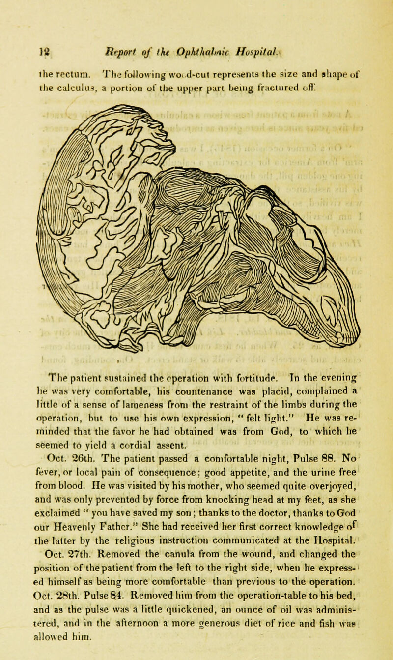 the rectum. The following wa d-cut represents the size and shape of the calculus, a portion of the upper part being fractured off. The patient sustained the operation with fortitude. In the evening he was very comfortable, his countenance was placid, complained a little of a sense of lameness from the restraint of the limbs during the operation, but to use his own expression,  felt light. He was re- minded that the favor he had obtained was from God, to which lie seemed to yield a cordial assent. Oct. 26th. The patient passed a comfortable night, Pulse 88. No fever, or local pain of consequence; good appetite, and the urine free from blood. He was visited by his mother, who seemed quite overjoyed, and was only prevented by force from knocking head at my feet, as she exclaimed  you have saved my son; thanks to the doctor, thanks to God our Heavenly Father. She had received her first correct knowledge of the latter by the religious instruction communicated at the Hospital. Oct. 27th. Removed the canula from the wound, and changed the position of the patient from the left to the right side, when he express- ed himself as being more comfortable than previous to the operation. Oct. 28th. Pulse 84. Removed him from the operation-table to his bed, and as the pulse was a little quickened, an ounce of oil was adminis- tered, and in the afternoon a more generous diet of rice and fish was allowed him.