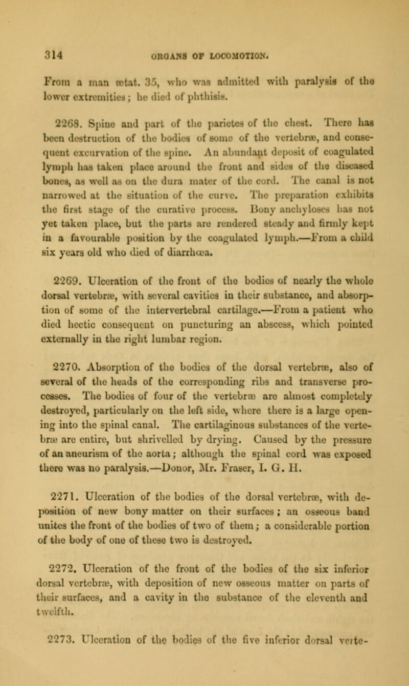 11 ultaANB OP LOCOMOTION. J'r .in i una was admitted with til of the- lov, oi phthk md part 11 Mm | hai n destruction of th quant Bzonrratioa of the ipine. An abundant d( | lymph has taken md the front an : :' thl diseased boms, .1 narrowed it th<- situation of 0m cum. exhibits the tir-: . the curati\e \ : < ■-. I><<nyanclnl not tukcu place, but thu parts arc rend' I iy md tirinly kept in ■ hTonmhh j»<>-^iti<• 11 l»y Um ooagulaied lymph.—From a child six years old who died of diarrhoea, 22G9. Ulceration of the front of the bodiai of nearly the whole dorsal vertebnr, \% itli ■ v< nil ca\ ilies 10 their substance, ai, tion of some of the intervertebral cartilage.—From a patient who died hectic consequent on puncturing m slreocas, which pointed externally in the right lumbar region. 8370i Ah- rption of the bodies of the dorsal rertebrss, also of several of the heads of the corresponding rib- and tr. pro- cesses. The bodies of four of the TSttobrsi are almost completely destroyed, particularly on the left side, where there is a laigo open- ing into the spinal canal. The cartilaginous sub-tames of the v. bra are entire, but shrivelled by drying. Caused by the pressure of an aneurism of the aorta; although the spinal cord osed there was no paralysis.—Donor, ICr. Fraser, 1. (J. II. 2*271. Ulceration of the bodies of the dorsal vertebnr, with de- position of new bony matter on their surfaces ; an OSSSSUS band unites the front of the bodies of two of them ; a considerable portion of the body of one of these two is jjflitTTrJ 2272. Ulceration of the front of the bodies of the six inn . .1 vertebra, with deposition of new osseous m . and a cavity in the sub-tauce of the eleventh and :<h. • ition of ■ 6ts inr- riot dorsal v I