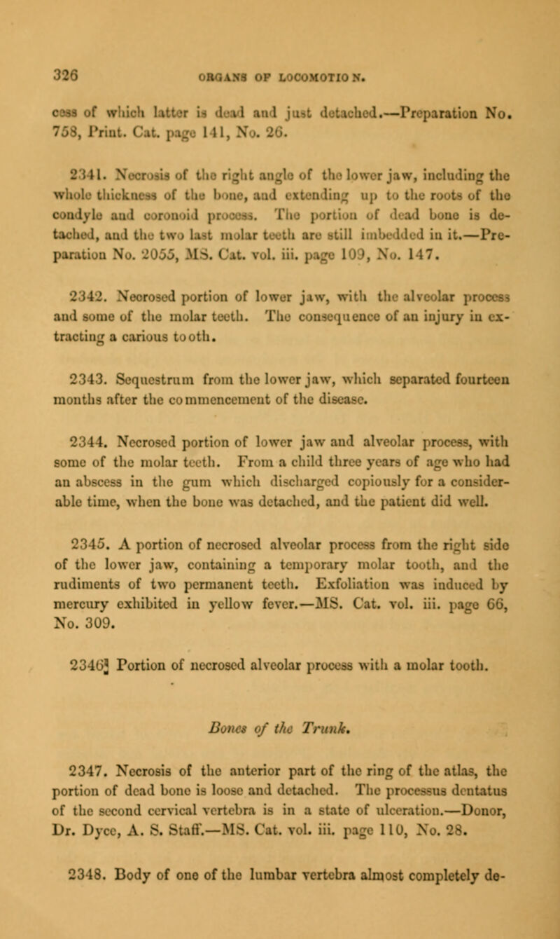 of which . -I': paration No. Print ('.it. pogs 111, N 2341. V I mt of tfa v, includi: '. • thickness Of t!i • 1> ttOj iad - it :i ling dp I tho o io Lj b end de- tached, to 1 t in it, — I'rc- ,rtion of town j.iw, with 1 process and some of the molar tooth. The I ail injury in tooting a ooriooj I >oth. \. Sequestrum from the lower jaw, which separated fo\ months after the eoinmcncemeut of the di- 1. Necrosed portion of lower jaw and alveolar process, with some of the molar teeth. From a ehild three yeoi who had an a i the gum which discharged copiously for a consider- able time, when the bone was detaehed, and the patient did well. 2345. A portion of necrosed alveolar process from the right sido of the lower jaw, containing a temporary moloi tooth, and the rudiments of two permanent teeth. Exfoliation was induce! mercury exhibited in yellow fever.—MS. Cat. vol. iii. | No. 309. 2340* Portion of necrosed alveolar process with a molar tooth. But us of the Trunk. 2347. Necrosis of the anterior part of the rin£ of the atlas, the portion of dead bone i- loOOB and detaehed. The 010000011 di ntatus of the second cerriceJ vertebra m in a state of oloerotkm,—Donor, Dr. Dye,. A. 3, EM iff.—MS. Get vol. iii. page 110, No. 28. 2348. Body of ono of the lumbar vertebra almost completely do-