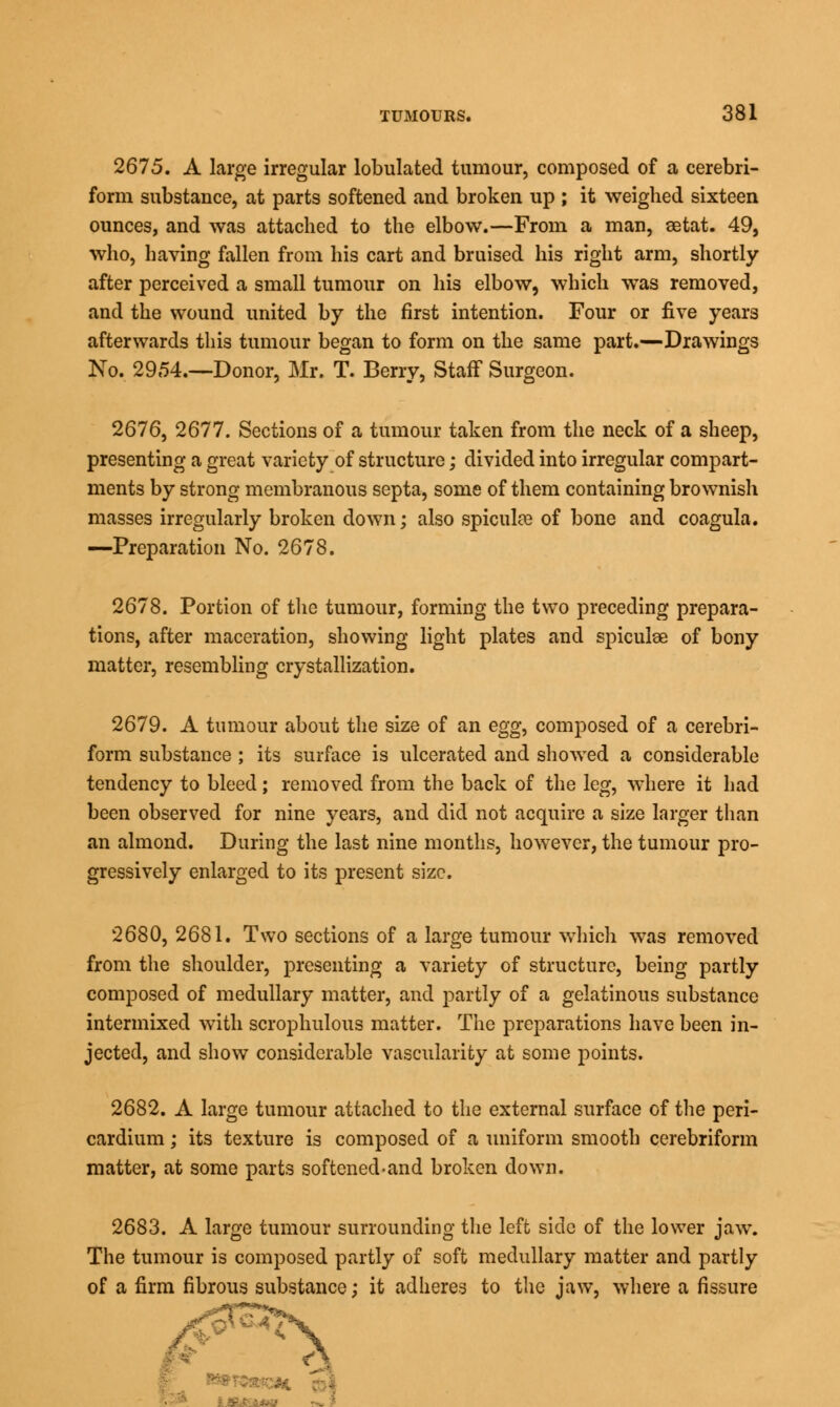 2675. A large irregular tabulated tumour, composed of a cerebri- form substance, at parts softened and broken up ; it weighed sixteen ounces, and was attached to the elbow.—From a man, aetat. 49, who, having fallen from his cart and bruised his right arm, shortly- after perceived a small tumour on his elbow, which was removed, and the wound united by the first intention. Four or five years afterwards this tumour began to form on the same part.—Drawings No. 2954.—Donor, Mr. T. Berry, Staff Surgeon. 2676, 2677. Sections of a tumour taken from the neck of a sheep, presenting a great variety of structure; divided into irregular compart- ments by strong membranous septa, some of them containing brownish masses irregularly broken down; also spiculce of bone and coagula. —Preparation No. 2678. 2678. Portion of the tumour, forming the two preceding prepara- tions, after maceration, showing light plates and spiculoe of bony matter, resembling crystallization. 2679. A tumour about the size of an egg, composed of a cerebri- form substance ; its surface is ulcerated and showed a considerable tendency to bleed; removed from the back of the leg, where it had been observed for nine years, and did not acquire a size larger than an almond. During the last nine months, however, the tumour pro- gressively enlarged to its present size. 2680. 2681. Two sections of a large tumour which wTas removed from the shoulder, presenting a variety of structure, being partly composed of medullary matter, and partly of a gelatinous substance intermixed with scrophulous matter. The preparations have been in- jected, and show considerable vascularity at some points. 2682. A large tumour attached to the external surface of the peri- cardium ; its texture is composed of a uniform smooth cerebriform matter, at some parts softened-and broken down. 2683. A laro-e tumour surroundino- the left side of the lower jaw. The tumour is composed partly of soft medullary matter and partly of a firm fibrous substance; it adheres to the jaw, where a fissure