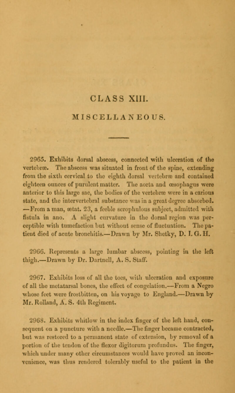 M I SCELLA \ EO US. 29G5. Exhibits dorsal abeceaa, connected with ulceration of the vertebra* The at is situated in front of the spine, extending from the sixth cervical (<> the eighth dorsal \ lined eighteen ounces of purulent matter. The aorta an I were anterior t<> this large sac, the 1 dies of the vertebra were in a cai state, and the intervertebral subetanc — Prom a man, ■ alous subject, admit! fistula in ano, curvature in the d oeptible with tnm but withoul tion. Th tient died of acute bronchitis.—Drawn by Mr. Shetky, D. I. <>. II. nts a large lumbar abscess, pointing in the left thigh.—Drawn by Dr. Dartnell, A. S. Staff. all the toes, with ulceration and exposure of all the metatarsal bones, the I Q, — Prom a N whose feet were frostbitten, on his ^ .land.—Drawn by Mr. Holland, A.S. 4th Regiment . 1.•'..'.'.. whitlow in the index . the left hand, con- ; nt on a puncture with a needle.—The fin but red to a permanent . by removal of a f the flex am profundus. Th which under many other cireumai venienoe, was thus rendei ly useful to the patient in the