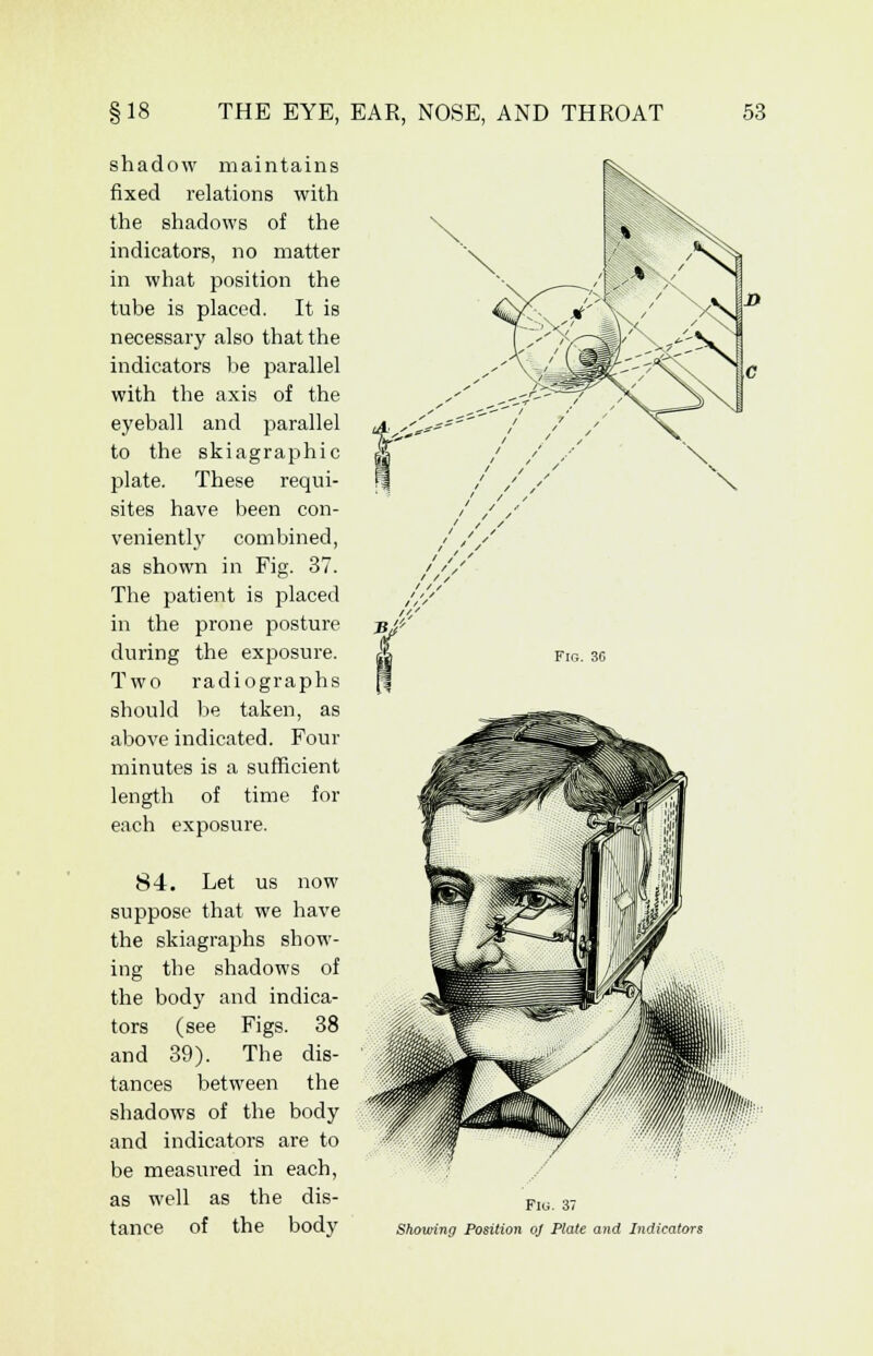 shadow maintains fixed relations with the shadows of the indicators, no matter in what position the tube is placed. It is necessary also that the indicators be parallel with the axis of the eyeball and parallel to the skiagraphic plate. These requi- sites have been con- veniently combined, as shown in Fig. 37. The patient is placed in the prone posture during the exposure. Two radiographs should be taken, as above indicated. Four minutes is a sufficient length of time for each exposure. 84. Let us now suppose that we have the skiagraphs show- ing the shadows of the body and indica- tors (see Figs. 38 and 39). The dis- tances between the shadows of the body and indicators are to be measured in each, as well as the dis- tance of the body / Fig. 36 Flu. 37 Showing Position oj Plate and Indicators