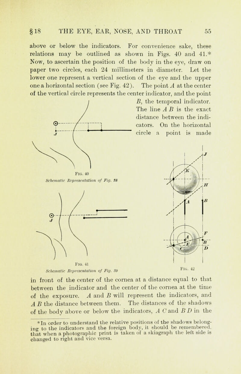 above or below the indicators. For convenience sake, these relations may be outlined as shown in Figs. 40 and 41.* Now, to ascertain the position of the body in the eye, draw on paper two circles, each 24 millimeters in diameter. Let the lower one represent a vertical section of the eye and the upper one a horizontal section (see Fig. 42). The point A at the center of the vertical circle represents the center indicator, and the point B, the temporal indicator. The line A B is the exact distance between the indi- cators. On the horizontal circle a point is made Fig. 40 Schematic Representation of Fig. 38 Fig. 42 Fig. 41 Schematic Representation of Fig. 39 in front of the center of the cornea at a distance equal to that between the indicator and the center of the cornea at the time of the exposure. A and B will represent the indicators, and A B the distance between them. The distances of the shadows of the body above or below the indicators, .4 C and B D in the *In order to understand the relative positions of the shadows belong- ing to the indicators and the foreign body, it should be remembered, that when a photographic print is taken of a skiagraph the left side is changed to right and vice versa.