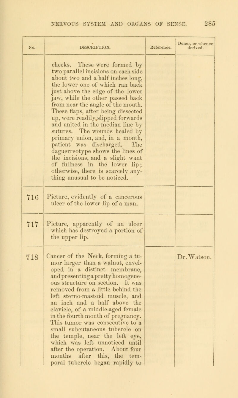 No. DESCRIPTION. Reference. Donor, or whence derived. cheeks. These were formed by two parallel incisions on each side about two and a half inches long, the lower one of which ran back just above the edge of the lower jaw, while the other passed back from near the angle of the mouth. These flaps, after being dissected up, were readily.slipped forwards and united in the median line by sutures. The wounds healed by primary union, and, in a month, patient was discharged. The daguerreotype shows the lines of the incisions, and a slight want of fullness in the lower lip; otherwise, there is scarcely any- thing unusual to be noticed. 716 Picture, evidently of a cancerous ulcer of the lower lip of a man. 1 1 Picture, apparently of an ulcer which has destroyed a portion of the upper lip. mor larger than a walnut, envel- oped in a distinct membrane, and presenting a pretty homogene- ous structure on section. It was removed from a little behind the left sterno-mastoid muscle, and an inch and a half above the clavicle, of a middle-aged female in the fourth month of pregnancy. This tumor was consecutive to a small subcutaneous tubercle on the temple, near the left eye, which was left unnoticed until after the operation. About four months after this, the tem- poral tubercle began rapidly to