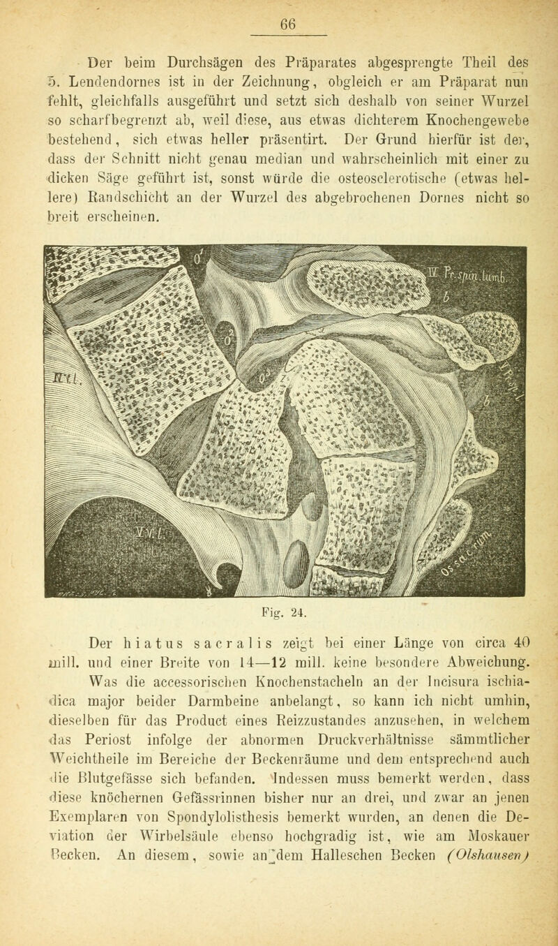 Der beim Durchsägen des Präparates abgesprengte Theil des 5. Lendendornes ist in der Zeichnung, obgleich er am Präparat nun fehlt, gleichfalls ausgeführt und setzt sich deshalb von seiner Wurzel so schai'fbegrenzt ab, weil diese, aus etwas dichterem Knochengewebe bestehend, sich etwas heller präsentirt. Der Grund bierfür ist der, dass der Schnitt nicht genau median und wahrscheinlich mit einer zu dicken Säge geführt ist, sonst würde die osteosclerotische (etwas hel- lere) Eandschicht an der Wurzel des abgebrochenen Dornes nicht so breit erscheinen. Fig. 24. Der hiatus sacralis zeigt bei einer Länge von circa 40 inill. und einer Breite von 14—12 mill. keine besondere Abweichung. Was die accessorischen Knochenstacheln an der Incisura ischia- dica major beider Darmbeine anbelangt, so kann ich nicht umhin, dieselben für das Product eines Reizzustandes anzusehen, in welchem das Periost infolge der abnormen Druckverhältnisse sämmtlieher Weichtheile im Bereiche der Beckenräume und dem entsprechend auch die Blutgefässe sich befanden. Indessen muss bemerkt werden, dass diese knöchernen Gefässrinnen bisher nur an drei, und zwar an jenen Exemplaren von Spondylolisthesis bemerkt wurden, an denen die De- viation der Wirbelsäule ebenso hochgradig ist, wie am Moskauer Recken. An diesem, sowie an^dem Halleschen Becken (Olshausen)