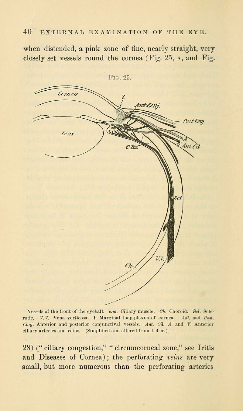 when distended, a pink zone of fine, nearly straight, very closely set vessels round the cornea (Fig. 25, a, and Fig. Vessels of the front of the eyeball, cm. Ciliary muscle. Ch. Choroid. Scl. Scle- rotic. V. V. Vena vorticosa. I. Marginal loop-plexus of cornea. Adt. aad Post. Conj. Anterior and posterior conjunctival vessels. Ant. OH. A. and V. Anterior ciliary arteries and veins. (Simplified and altered from Leber.)j 28) ( ciliary congestion,  circumcorneal zone, see Iritis and Diseases of Cornea); the perforating veins are very small, but more numerous than the perforating arteries