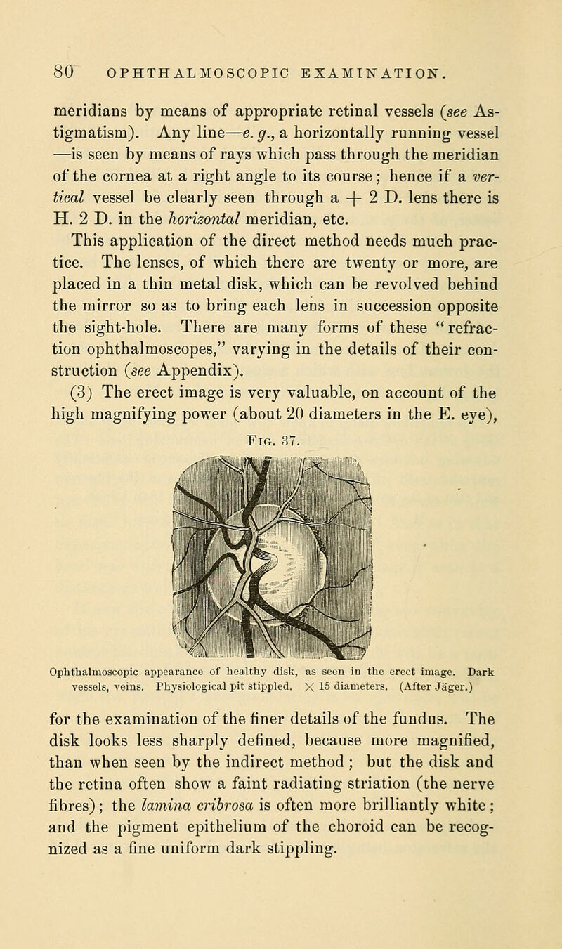 meridians by means of appropriate retinal vessels (see As- tigmatism). Any line—e. g., a horizontally running vessel —is seen by means of rays which pass through the meridian of the cornea at a right angle to its course; hence if a ver- tical vessel be clearly seen through a-f 2D. lens there is H. 2 D. in the horizontal meridian, etc. This application of the direct method needs much prac- tice. The lenses, of which there are twenty or more, are placed in a thin metal disk, which can be revolved behind the mirror so as to bring each lens in succession opposite the sight-hole. There are many forms of these refrac- tion ophthalmoscopes, varying in the details of their con- struction (see Appendix). (3) The erect image is very valuable, on account of the high magnifying power (about 20 diameters in the E. eye), Fig. 37. Ophthalmoscopic appearance of healthy disk, as seen in the erect image. Dark vessels, veins. Physiological pit stippled. X 15 diameters. (After Jager.) for the examination of the finer details of the fundus. The disk looks less sharply defined, because more magnified, than when seen by the indirect method ; but the disk and the retina often show a faint radiating striation (the nerve fibres); the lamina cribrosa is often more brilliantly white ; and the pigment epithelium of the choroid can be recog- nized as a fine uniform dark stippling.