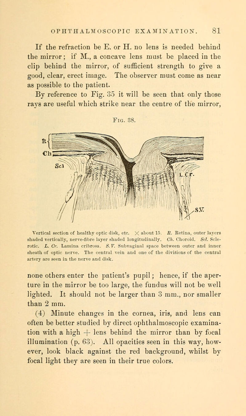 If the refraction be E. or H. no lens is needed behind the mirror; if M., a concave lens must be placed in the clip behind the mirror, of sufficient strength to give a good, clear, erect image. The observer must come as near as possible to the patient. By reference to Fig. 35 it will be seen that only those rays are useful which strike near the centre of the mirror, Fig. 38. Vertical section of healthy optic disk, etc. X about 15. B. Retina, outer layers shaded vertically, nerve-fibre layer shaded longitudinal!}'. Ch. Choroid. Scl. Scle- rotic. L. Or. Lamina cribrosa. S.V. Subvagiual space between outer and inner sheath of optic nerve. The central vein and one of the divisions of the central artery are seen in the nerve and disk. none others enter the patient's pupil; hence, if the aper- ture in the mirror be too large, the fundus will not be well lighted. It should not be larger than 3 mm., nor smaller than 2 mm. (4) Minute changes in the cornea, iris, and lens can often be better studied by direct ophthalmoscopic examina- tion with a high -j- lens behind the mirror than by focal illumination (p. 63). All opacities seen in this way, how- ever, look black against the red background, whilst by focal light they are seen in their true colors.