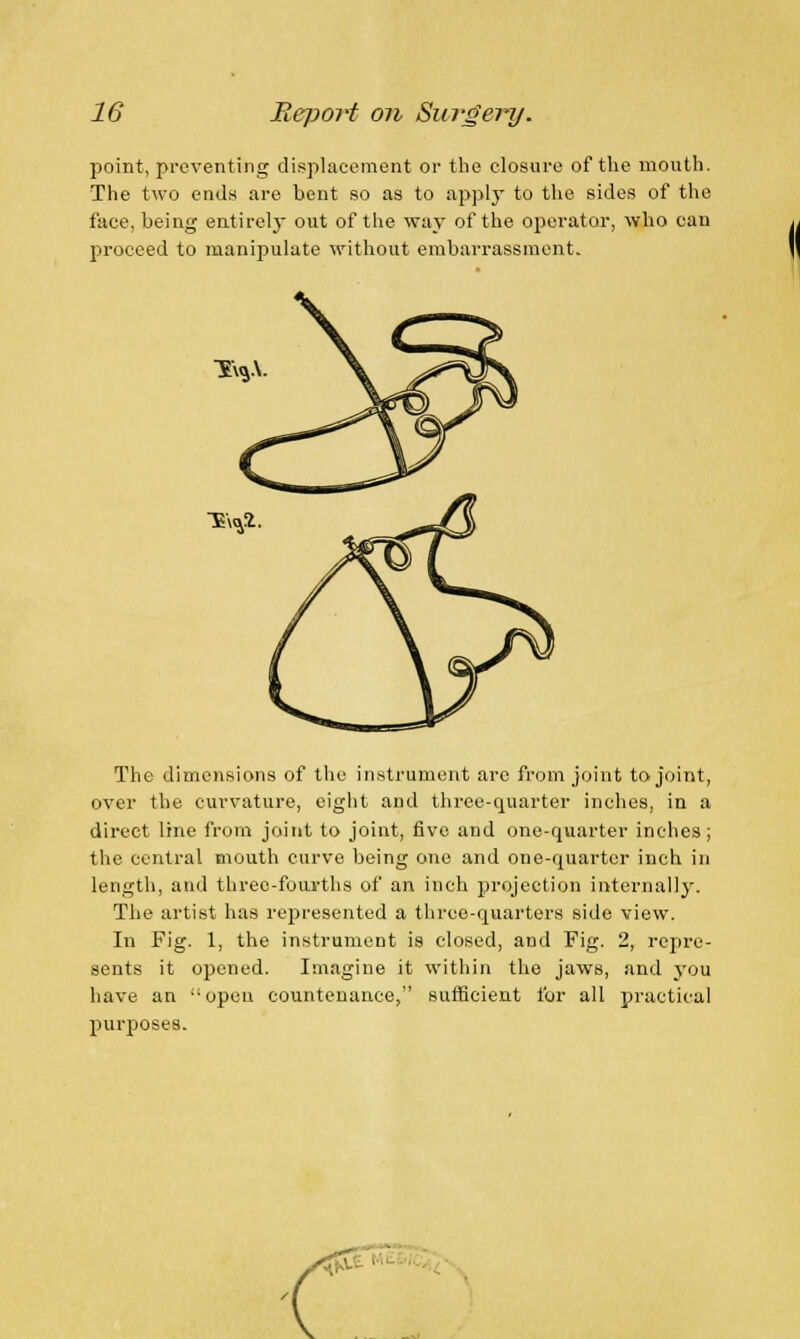 point, preventing displacement or the closure of the mouth. The two ends are bent so as to apply to the sides of the face, being entirely out of the way of the operator, who can proceed to manipulate without embarrassment. X\*V ■»%*• The dimensions of the instrument are from joint to joint, over the curvature, eight and three-quarter inches, in a direct line from joint to joint, five and one-quarter inches; the central mouth curve being one and one-quarter inch in length, and three-fourths of an inch projection internally. The artist has represented a three-quarters side view. In Fig. 1, the instrument is closed, and Fig. 2, repre- sents it opened. Imagine it within the jaws, and you have an open countenance, sufficient for all practical purposes. <££ ■