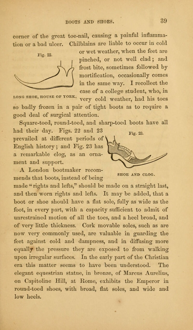 corner of the great toe-nail, causing a painful inflamma- tion or a bad ulcer. Chilblains are liable to occur in cold or wet weather, when the feet are Fi«. 22. pinched, or not well clad; and frost bite, sometimes followed by- mortification, occasionally comes in the same way. I recollect the case of a college student, who, in LONG SHOE, HOUSE OF TOEK. , , ,, T, 1 1 • j-^„„ very cold weather, had his toes so badly frozen in a pair of tight boots as to require a good deal of surgical attention. Square-toed, round-toed, and sharp-toed boots have all had their day. Figs. 22 and 23 Fi ^ prevailed at different periods of' English history; and Fig. 23 has a remarkable clog, as an orna- ment and support. A London bootmaker recom- _ , , . n . SHOE AND CLOG. mends that boots, instead of being made  rights and lefts, should be made on a straight last, and then worn rights and lefts. It may be added, that a boot or shoe should have a flat sole, fully as wide as the foot, in every part, with a capacity sufficient to admit of unrestrained motion of all the toes, and a heel broad, and of very little thickness. Cork movable soles, such as are now very commonly used, are valuable in guarding the feet against cold and dampness, and in diffusing more equally the pressure they are exposed to from walking upon irregular surfaces. In the early part of the Christian era this matter seems to have been understood. The elegant equestrian statue, in bronze, of Marcus Aurelius, on Capitoline Hill, at Rome, exhibits the Emperor in round-toed shoes, with broad, flat soles, and wide and low heels.